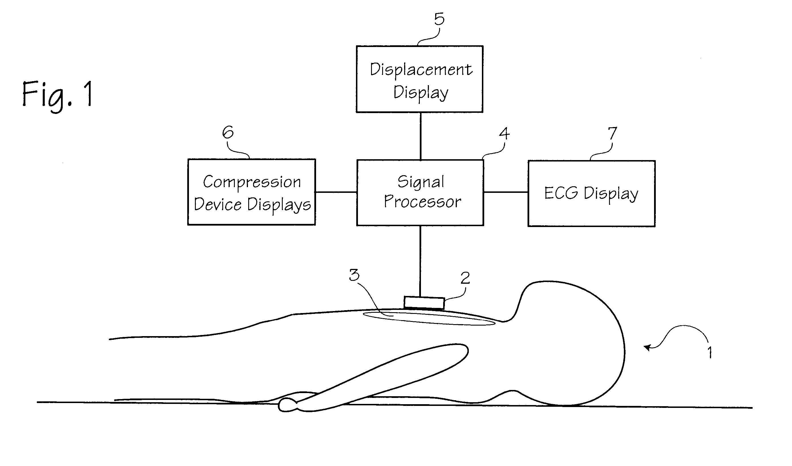 Method of determining depth of compressions during cardio-pulmonary resuscitation