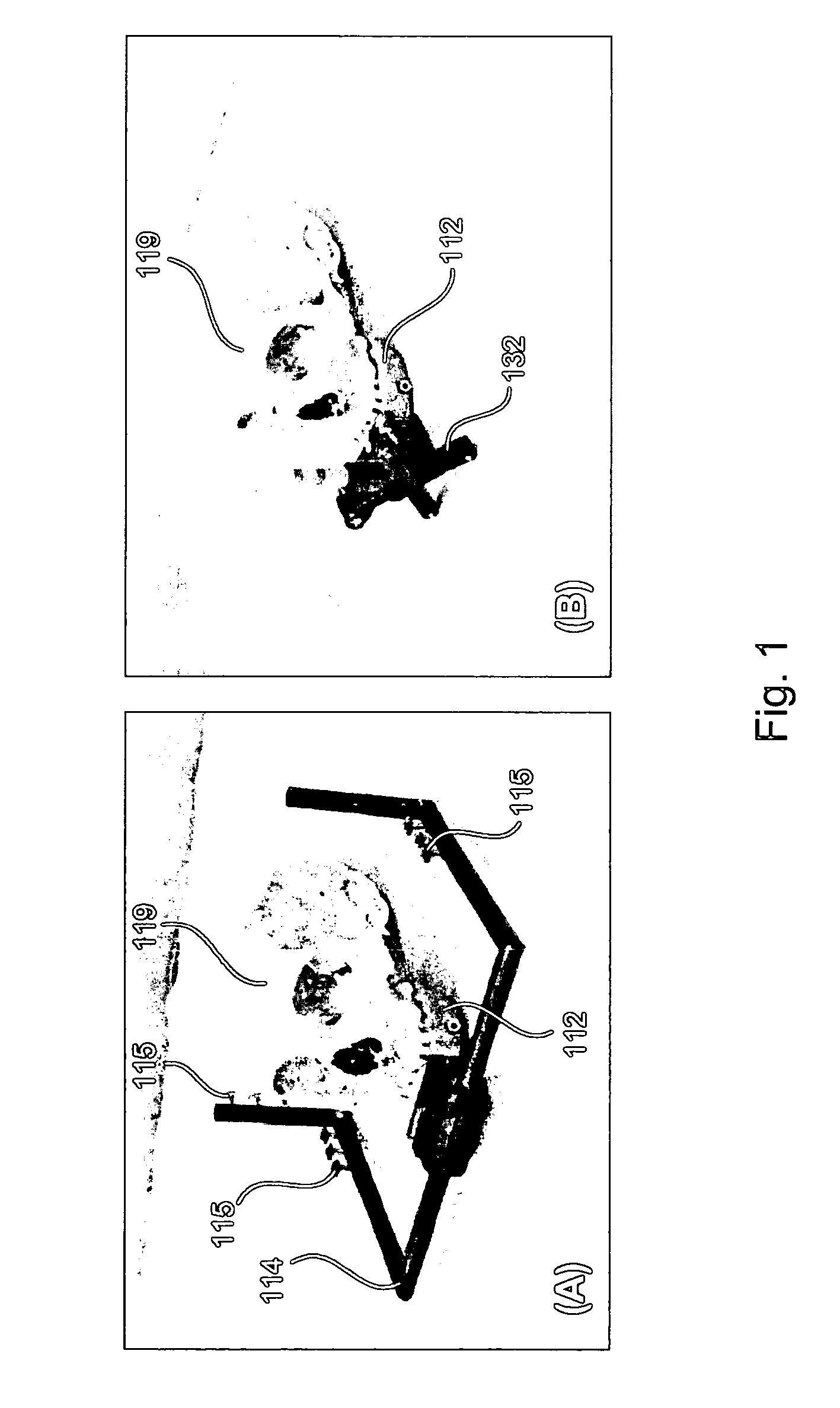 System and methods of using image-guidance for providing an access to a cochlear of a living subject