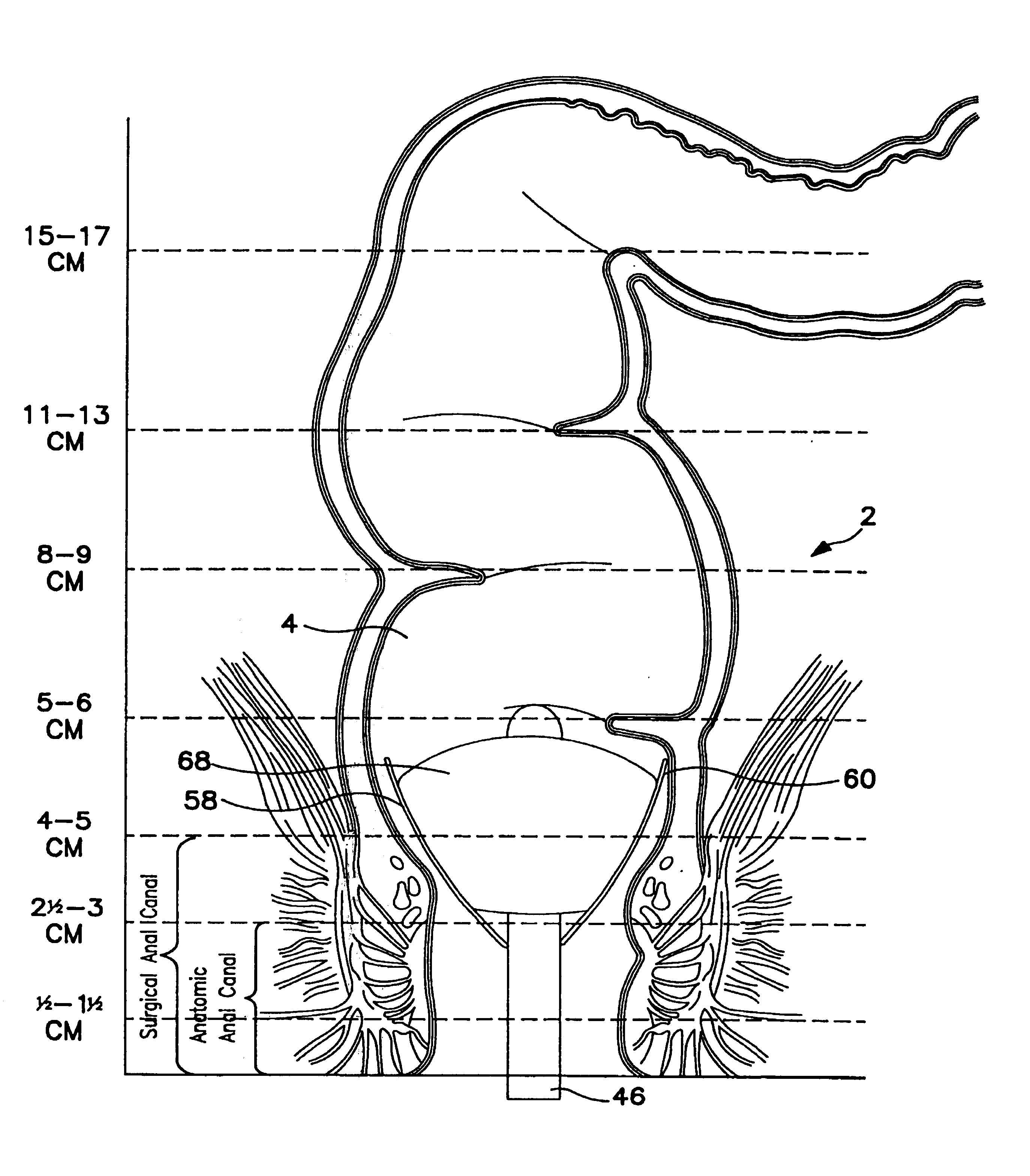 Method and apparatus for quantifying nerve and neural-muscular integrity related to pelvic organs or pelvic floor functions