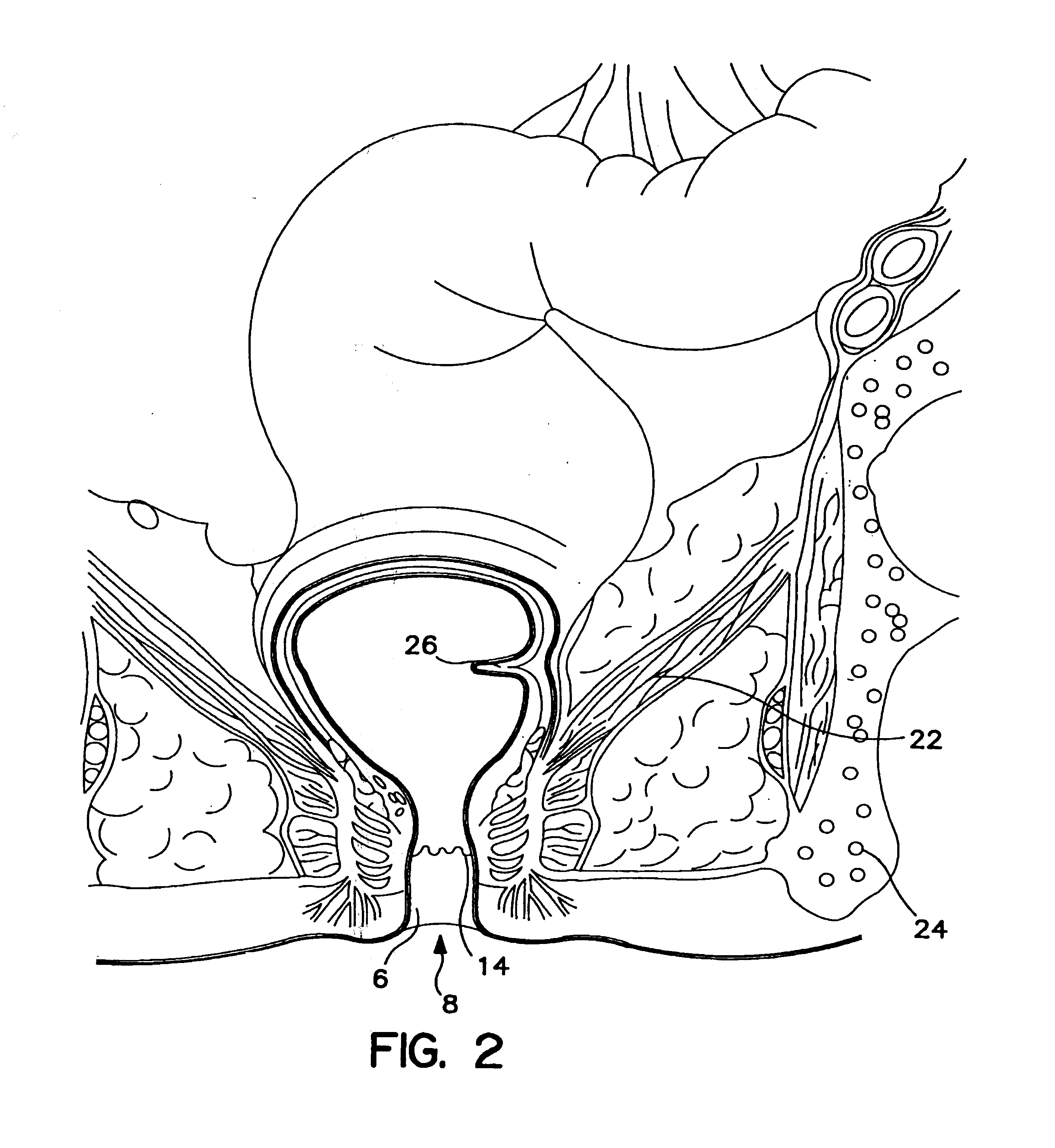 Method and apparatus for quantifying nerve and neural-muscular integrity related to pelvic organs or pelvic floor functions