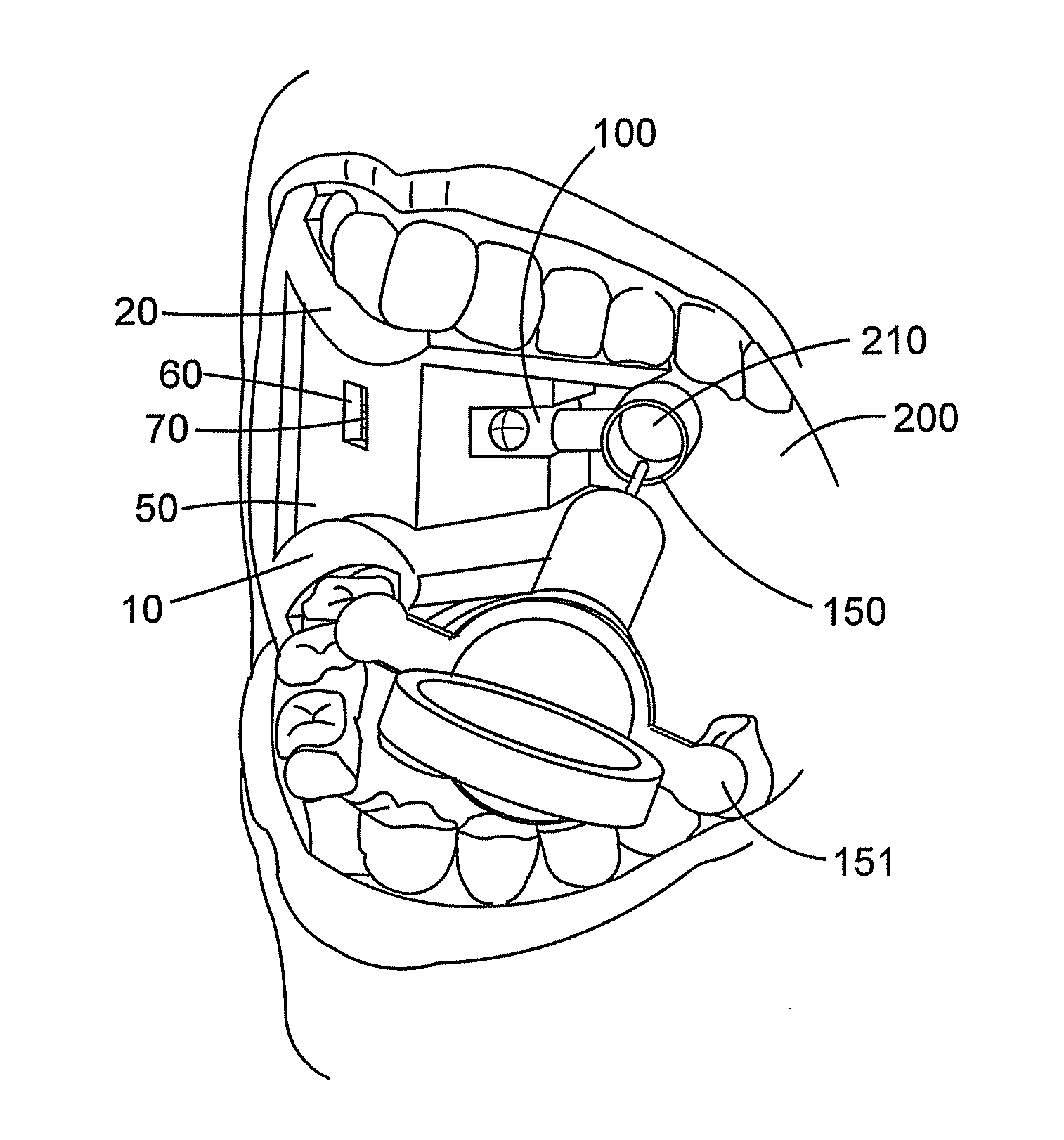 Device for selective targeting of a substance to a body part