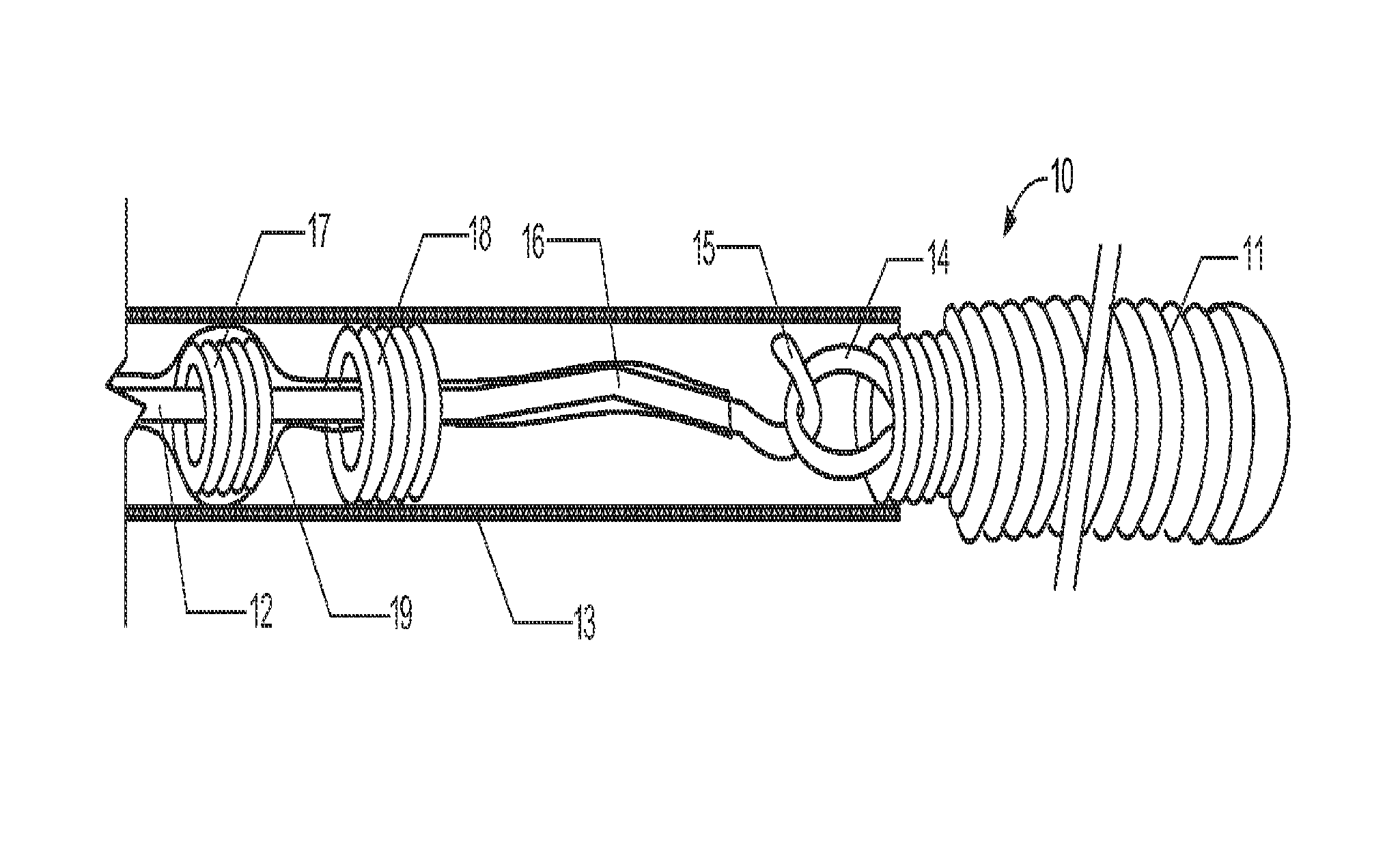 Delivery assembly for occlusion device using mechanical interlocking coupling mechanism