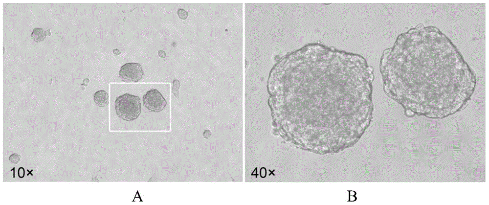 Method for inducing Muse cells in adult bone marrow into neural precursor cells (NPCs)