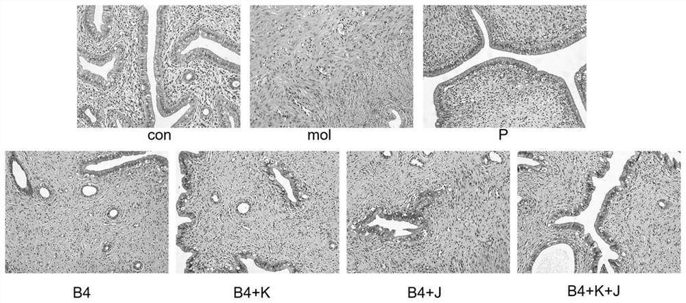 Application of pulsatilla saponin B4 in preparation of medicine for treating or preventing hysteromyoma