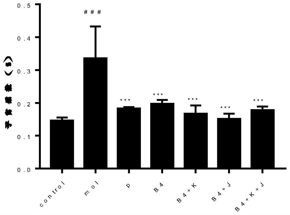 Application of pulsatilla saponin B4 in preparation of medicine for treating or preventing hysteromyoma