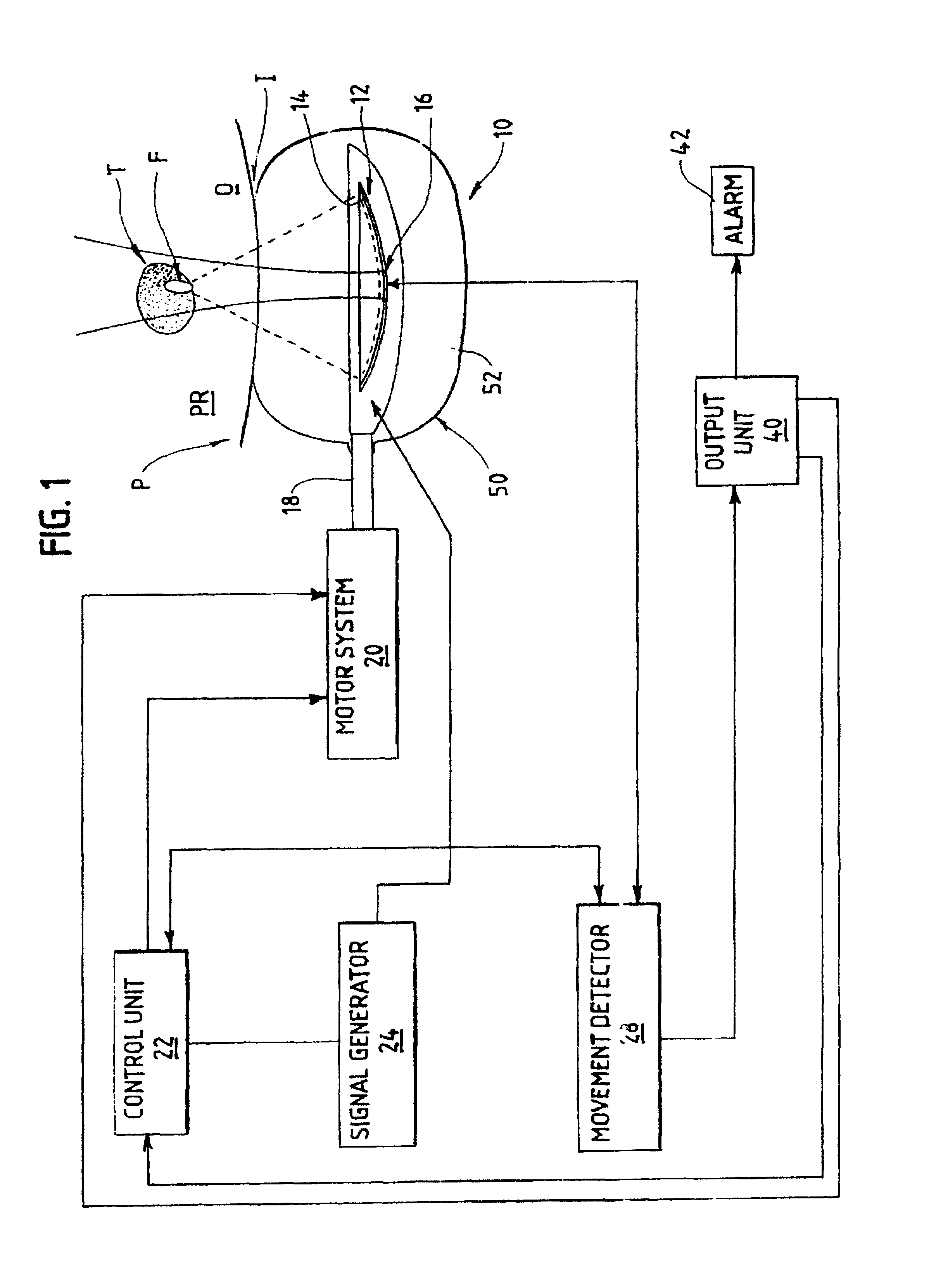 Use of a-mode echography for monitoring the position of a patient during ultrasound therapy