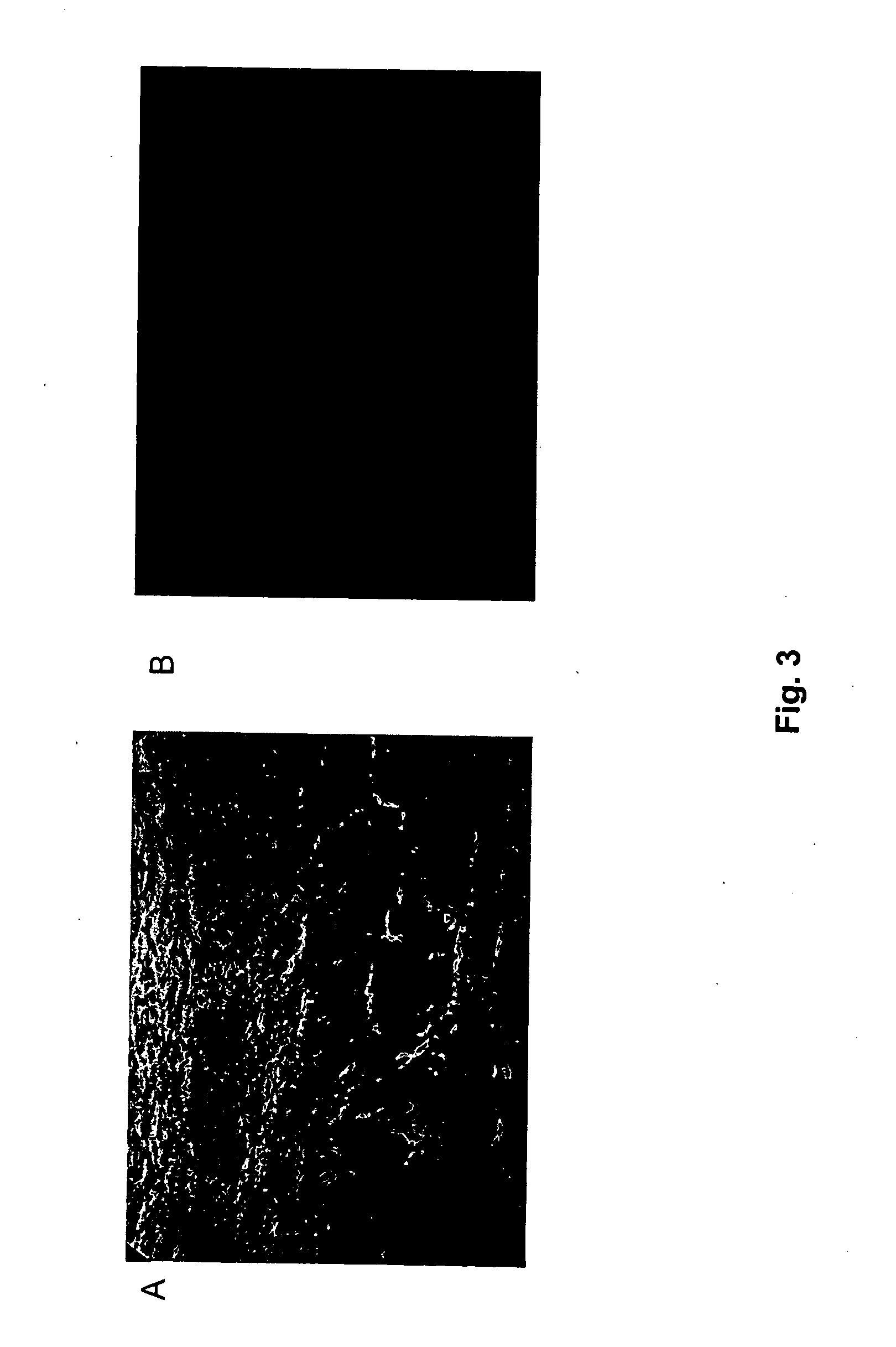 Novel recombinant poxvirus composition and uses thereof