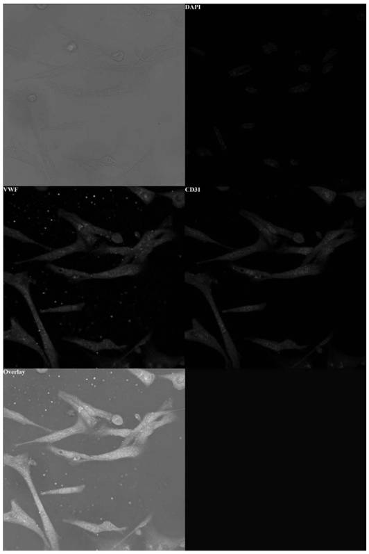 Brain microvascular endothelial cell extraction and purification method