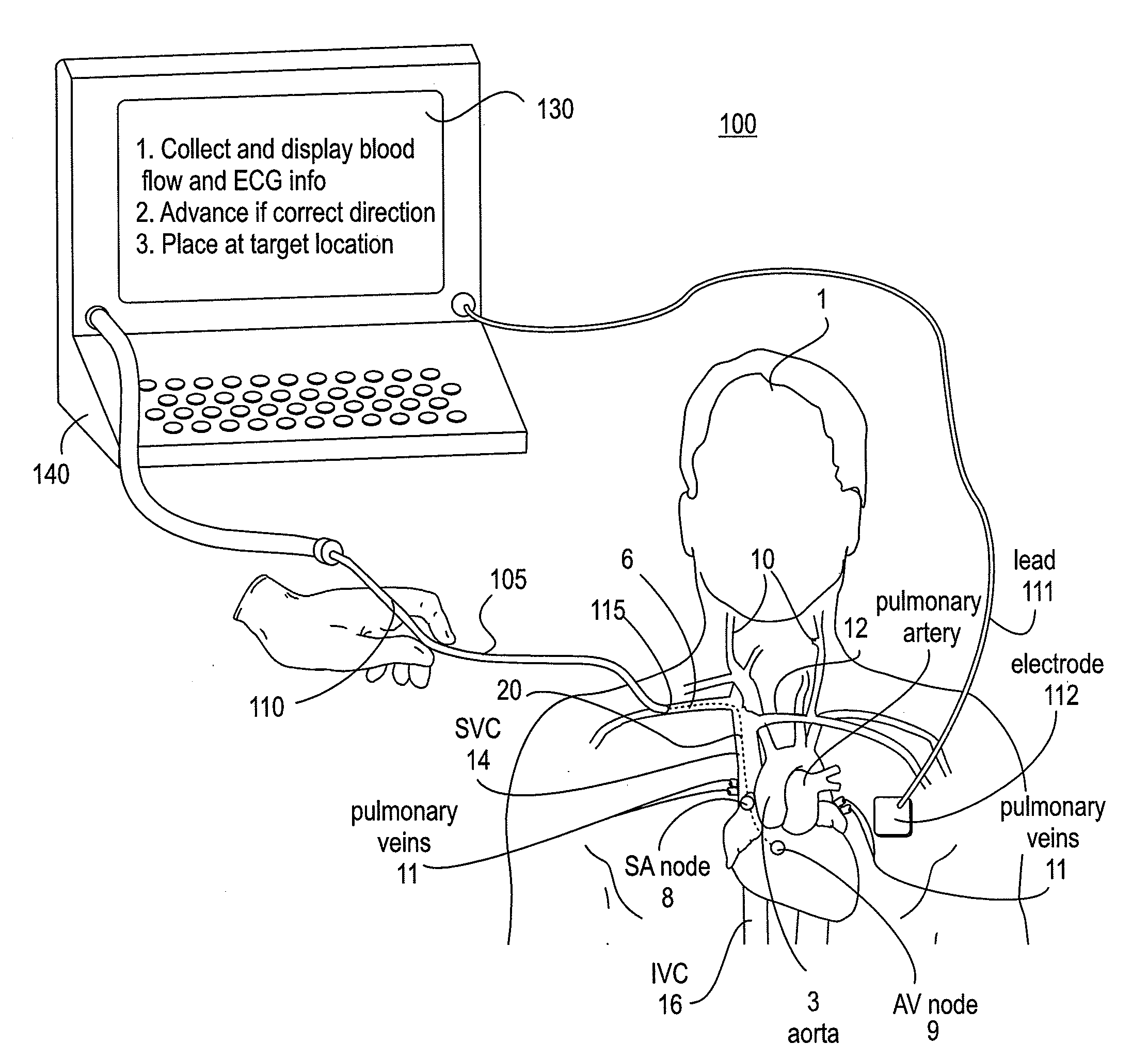 Apparatus and Method for Endovascular Device Guiding and Positioning Using Physiological Parameters