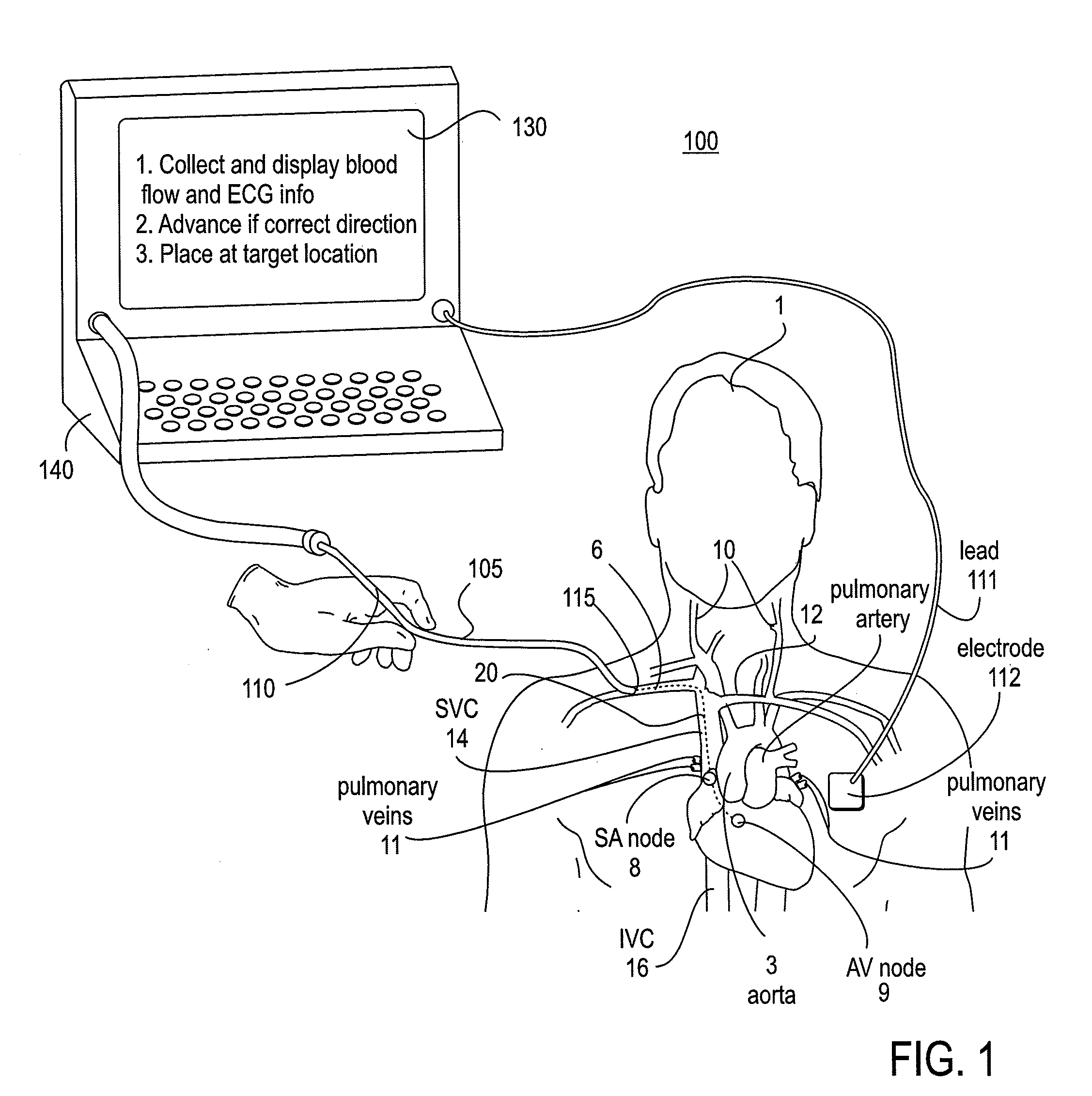 Apparatus and Method for Endovascular Device Guiding and Positioning Using Physiological Parameters