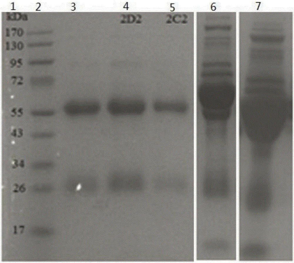 Preparation method and application of bacillus cereus monoclonal antibody
