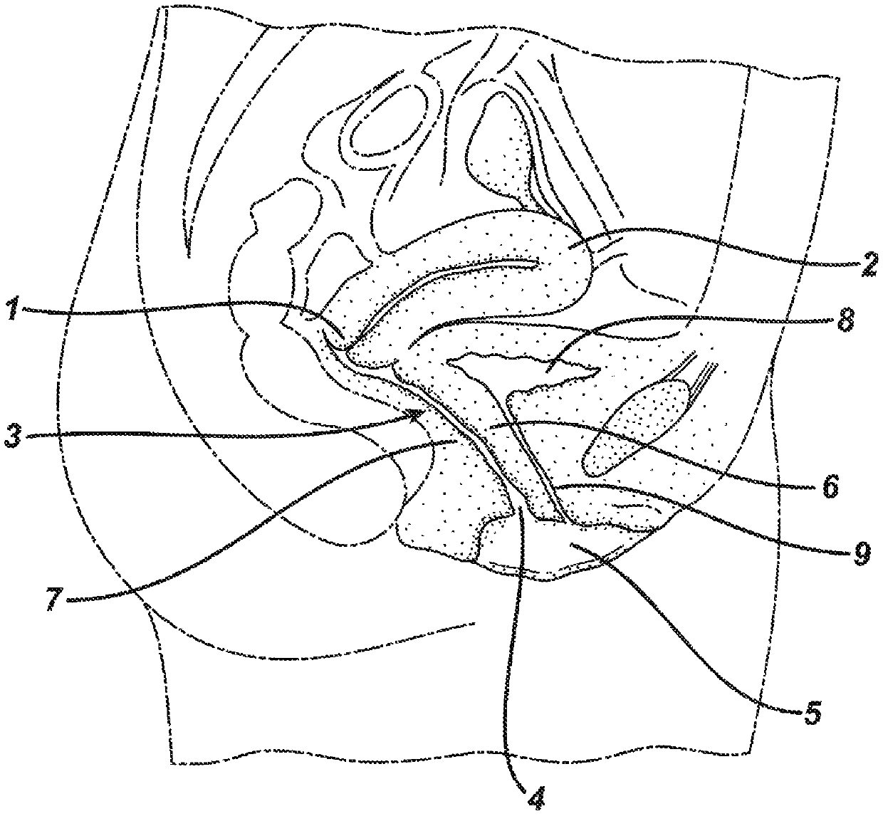 Methods and apparatus for in vitro testing of medical devices