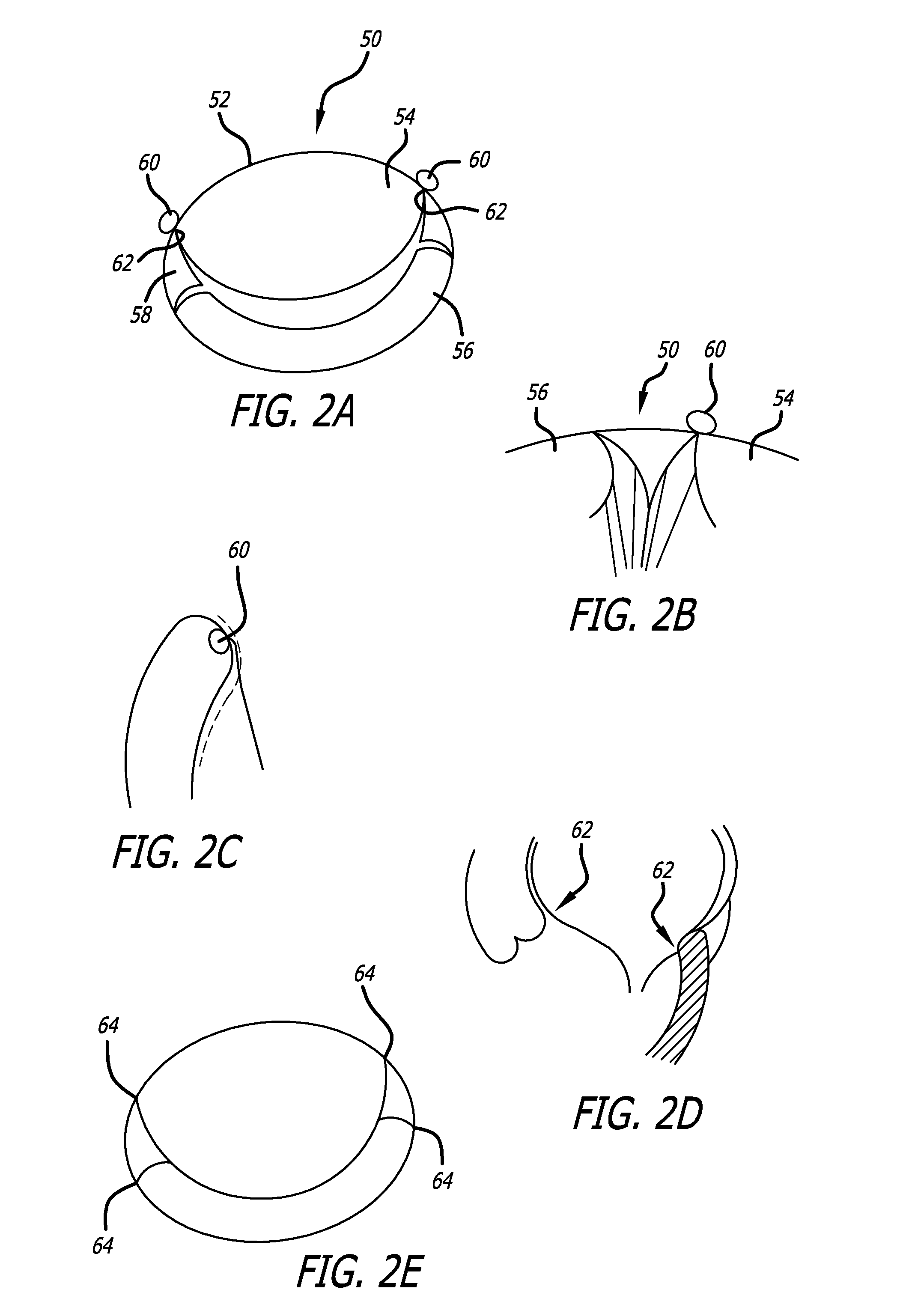 Valve replacement systems and methods