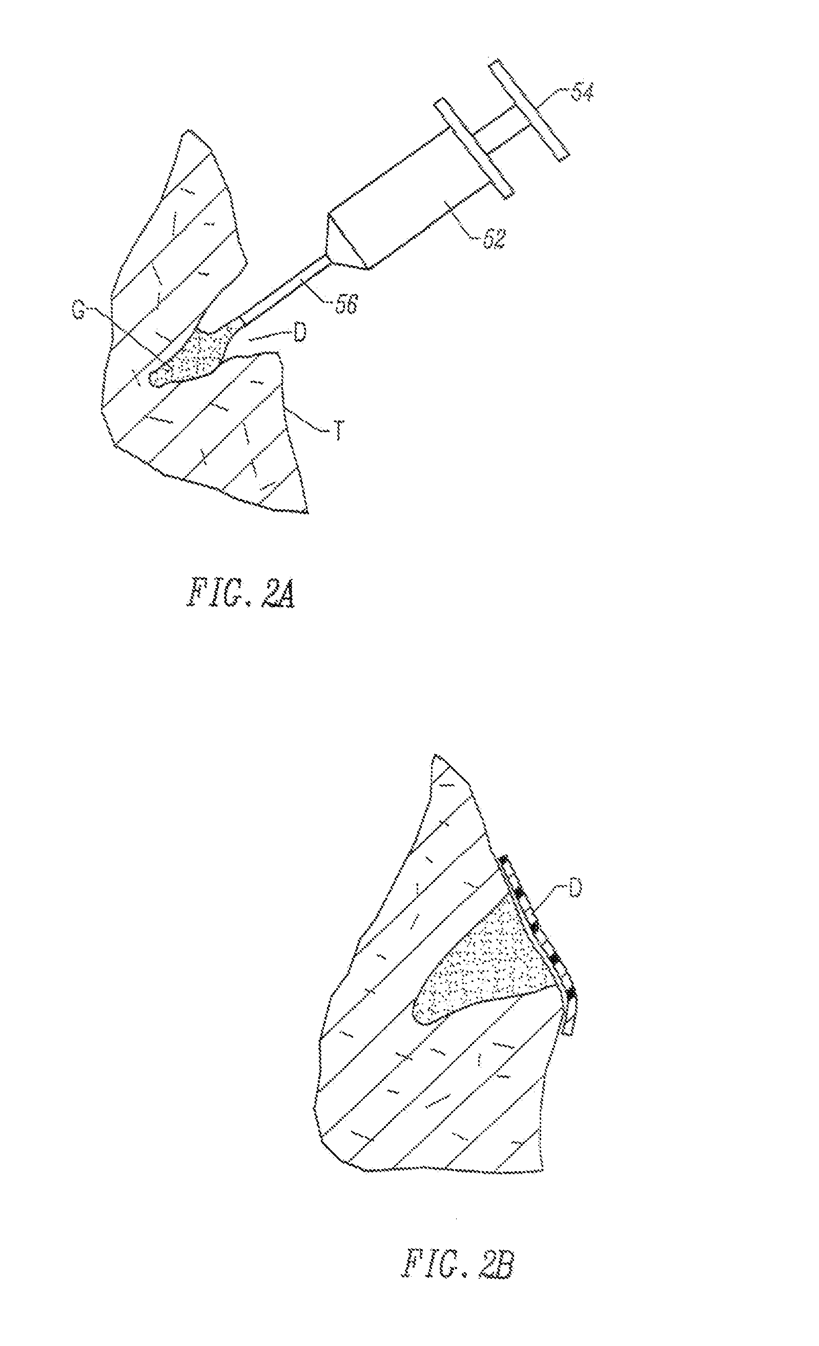 Fragmented polymeric compositions and methods for their use