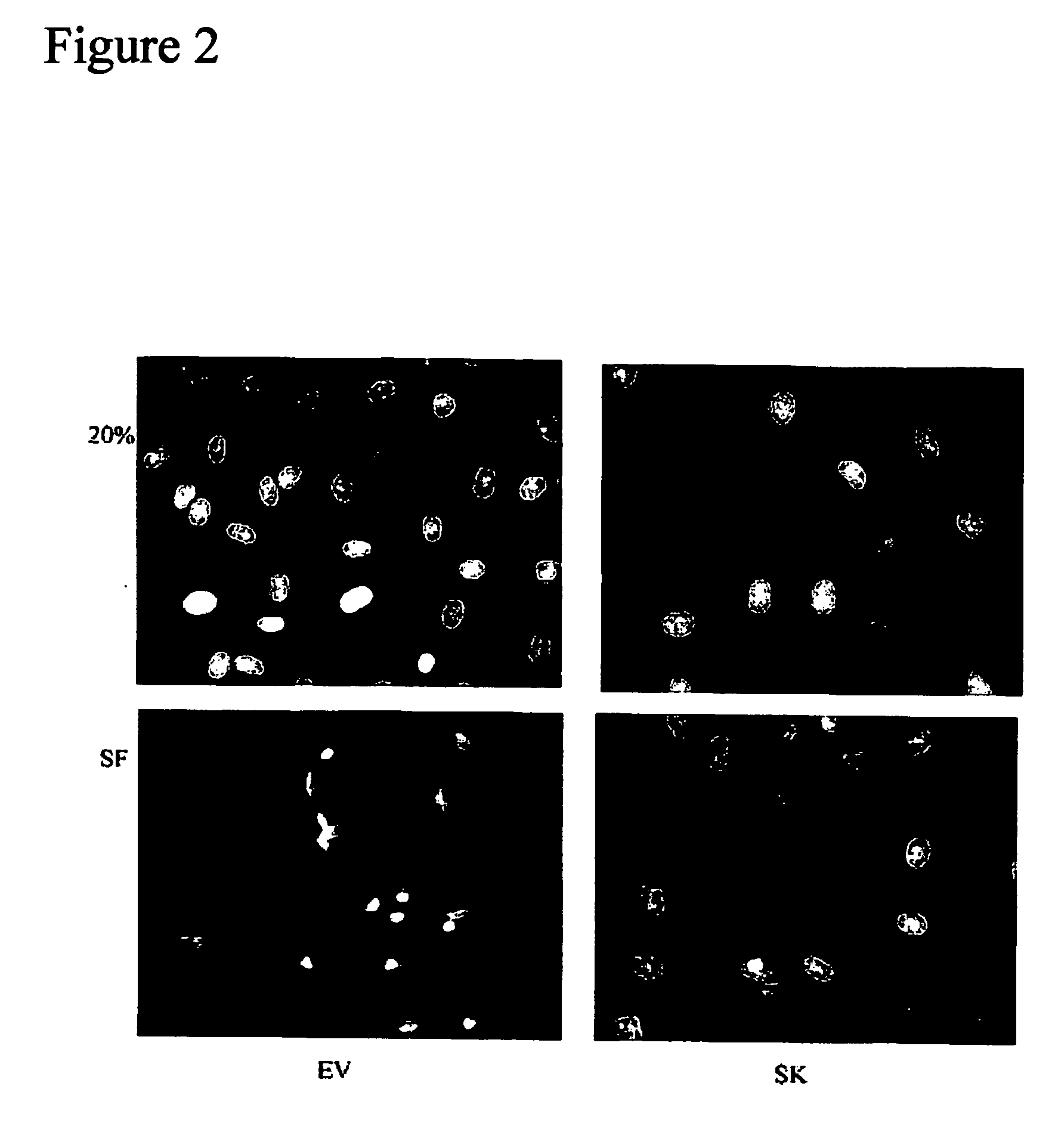 Method of modulating epithelial cell activity by modulating the functional levels of sphingosine kinase