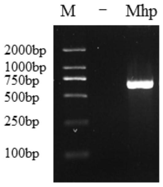 Primer group for detecting mycoplasma hyopneumoniae, application of primer group and real-time fluorescent quantitative PCR detection method