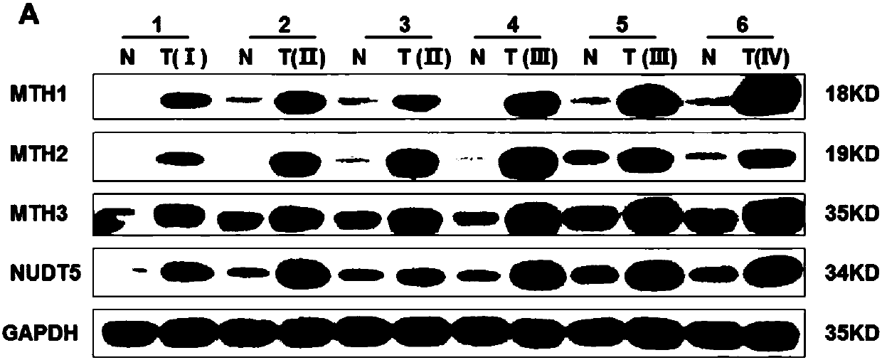 Marker for determining prognosis of colorectal cancer and application thereof