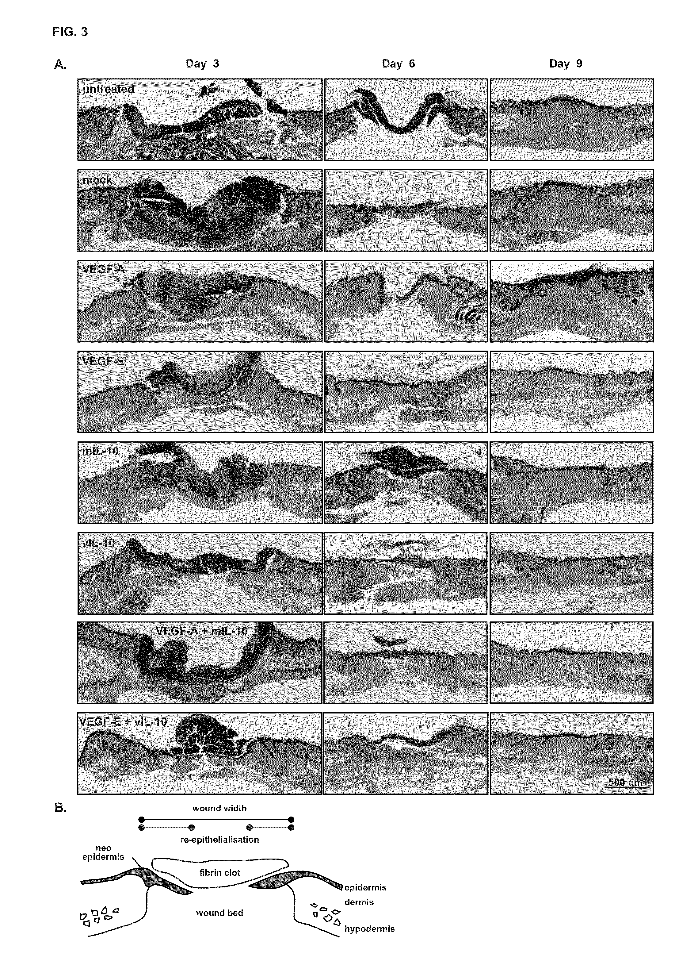 Combination Treatments and Compositions for Wound Healing
