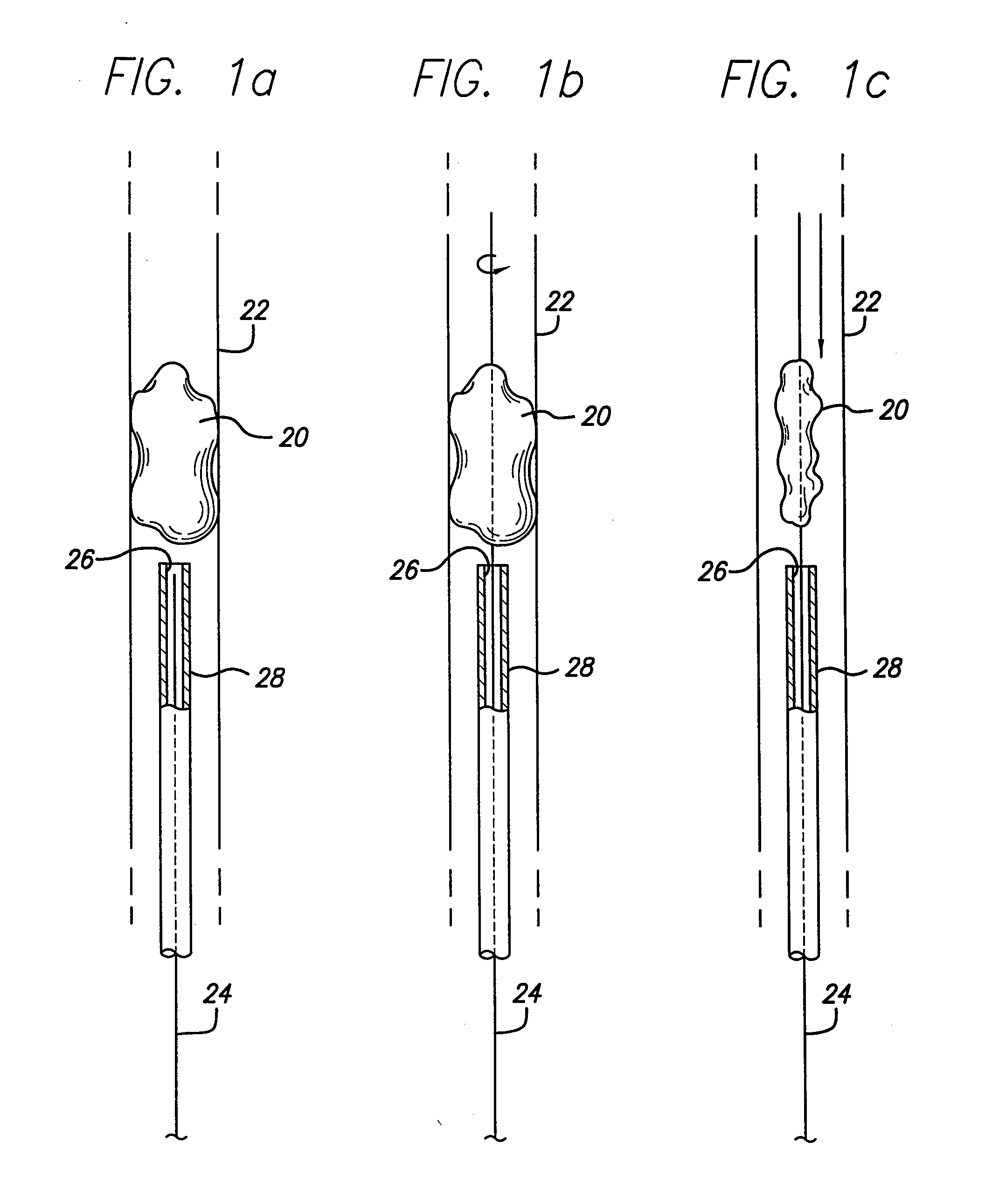Filter/emboli extractor for use in variable sized blood vessels
