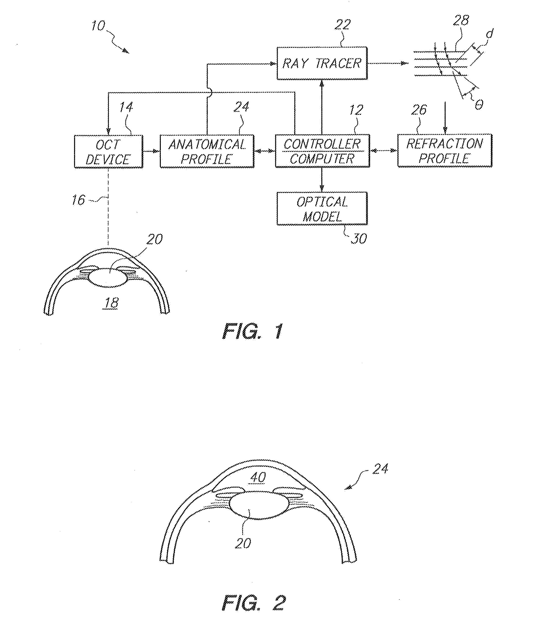 Method and System for Combining OCT and Ray Tracing to Create an Optical Model for Achieving a Predictive Outcome