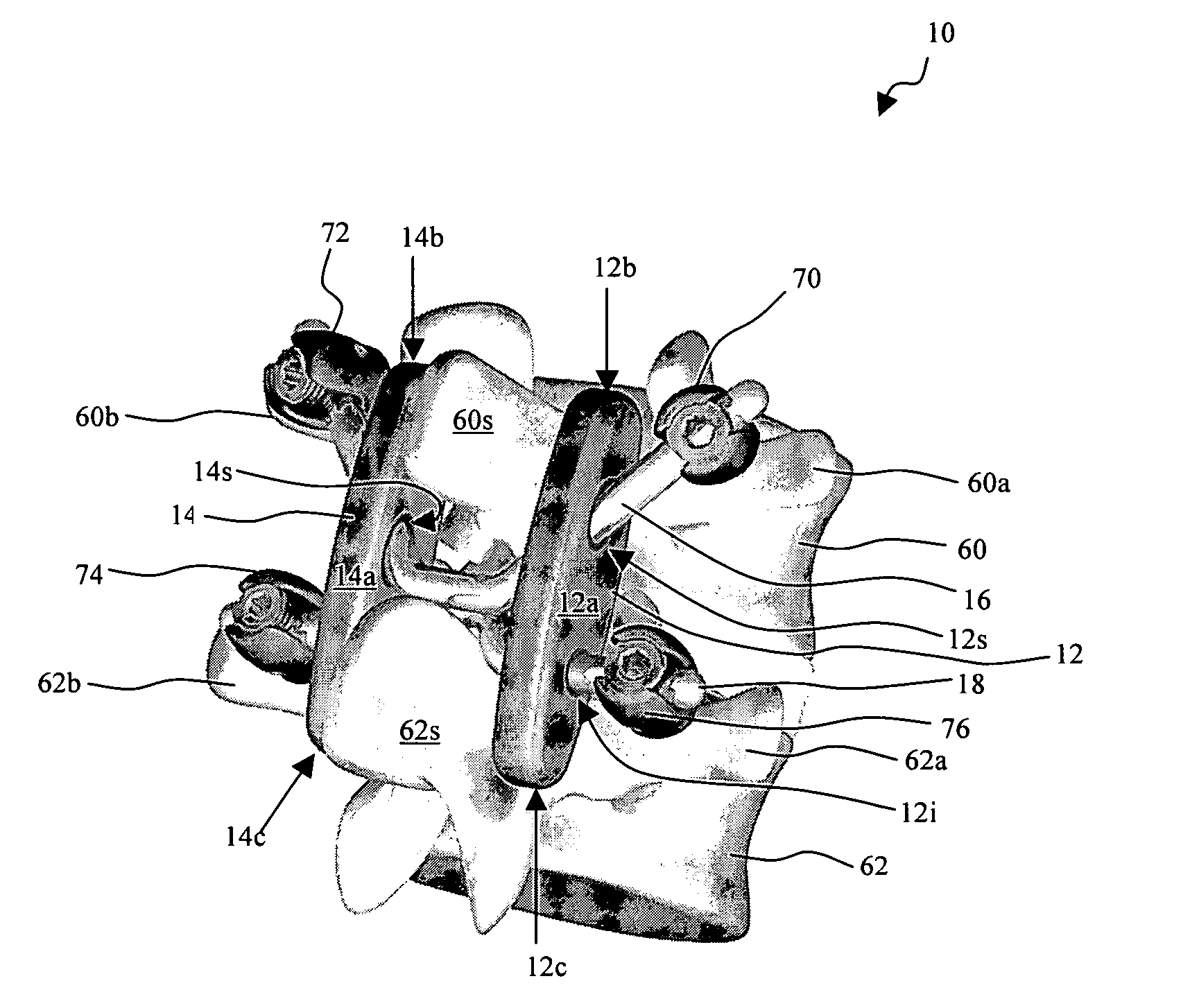 Posterior stabilization systems and methods