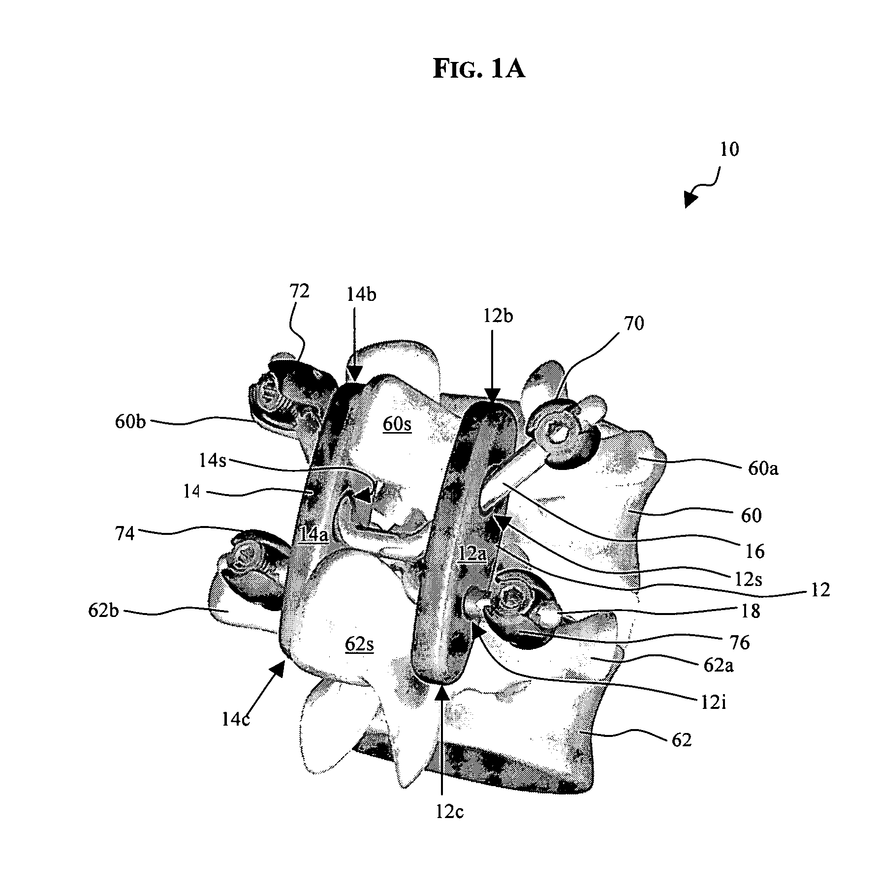 Posterior stabilization systems and methods