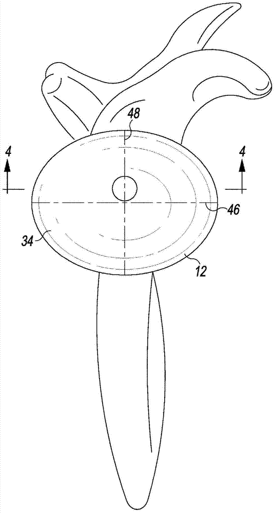 Reverse shoulder orthopaedic implant having a metaglene component with a screw locking cap