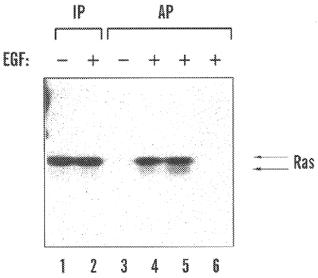 Activated ras interaction assay