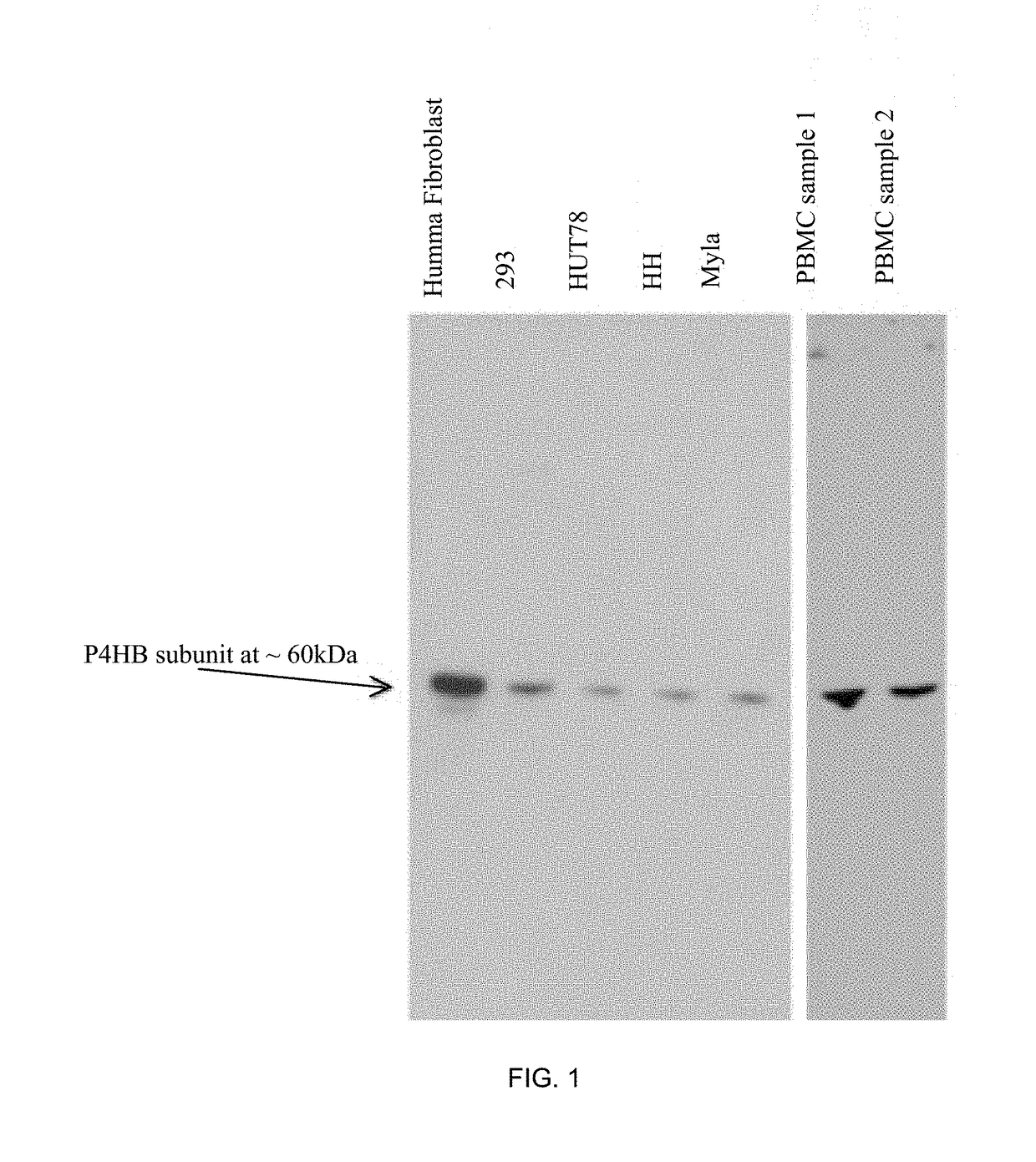 Treatment of epidermolysis bullosa by injection of autologous collagen vii overexpressing leukocytes