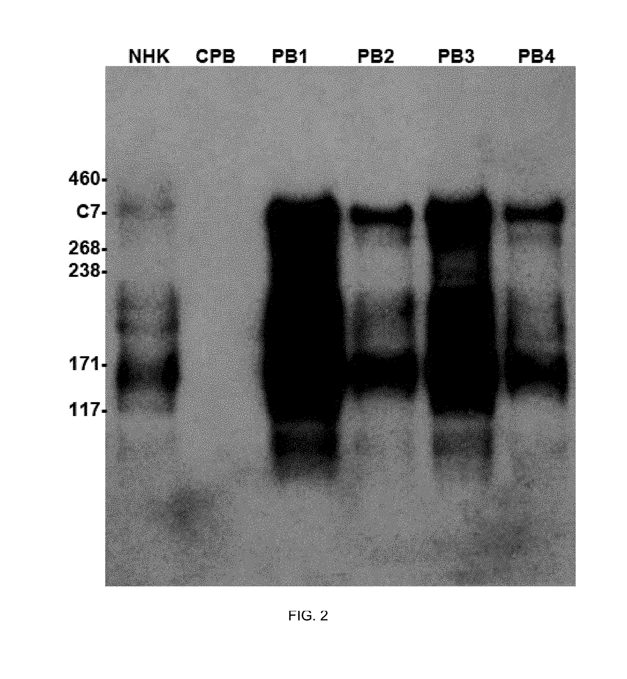 Treatment of epidermolysis bullosa by injection of autologous collagen vii overexpressing leukocytes