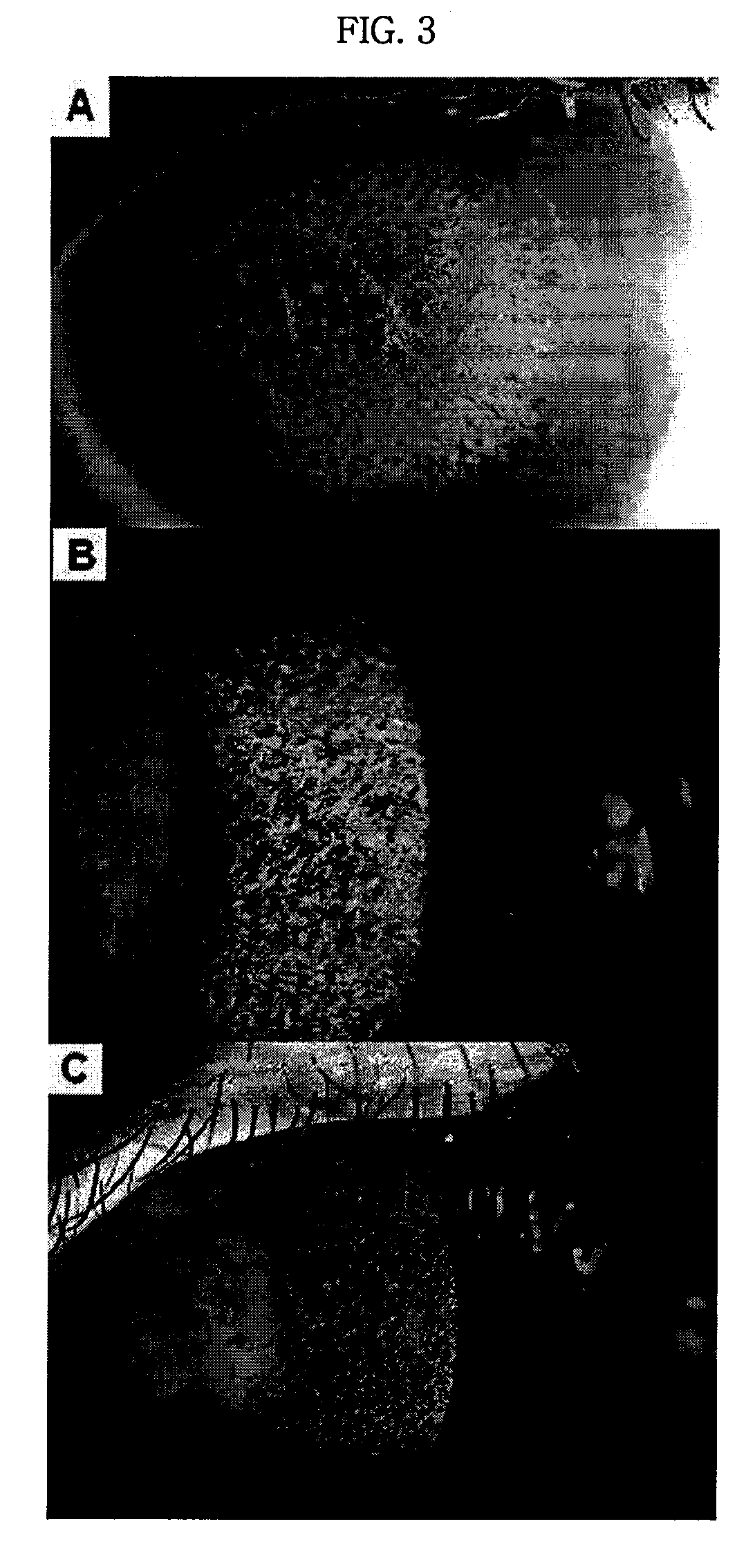 Pharmaceutical Composition for Treating Avellino Cornea Dystrophy Comprising Blood Plasma or Serum
