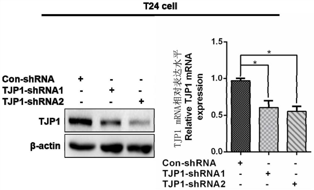 Bladder cancer biomarker tjp1 and its application