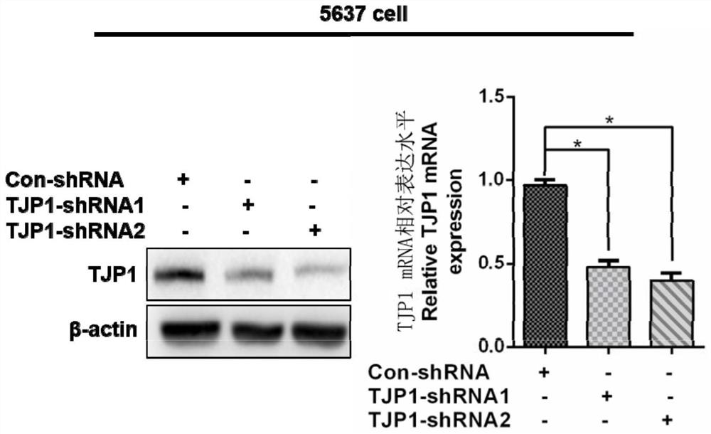 Bladder cancer biomarker tjp1 and its application