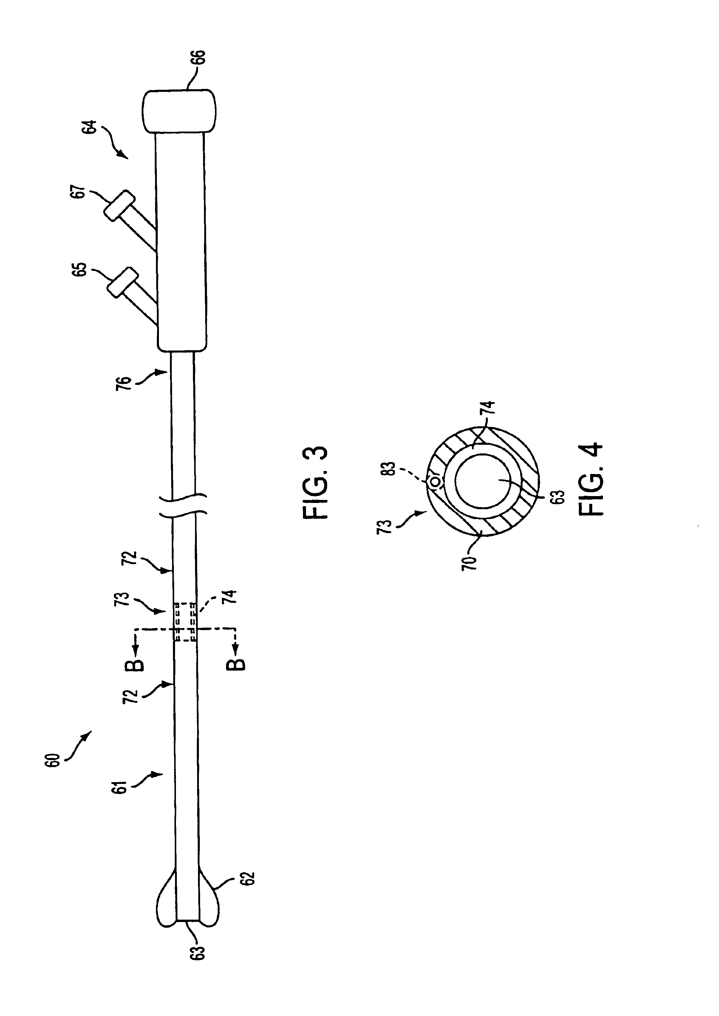 Catheter having a compliant member configured to regulate aspiration rates