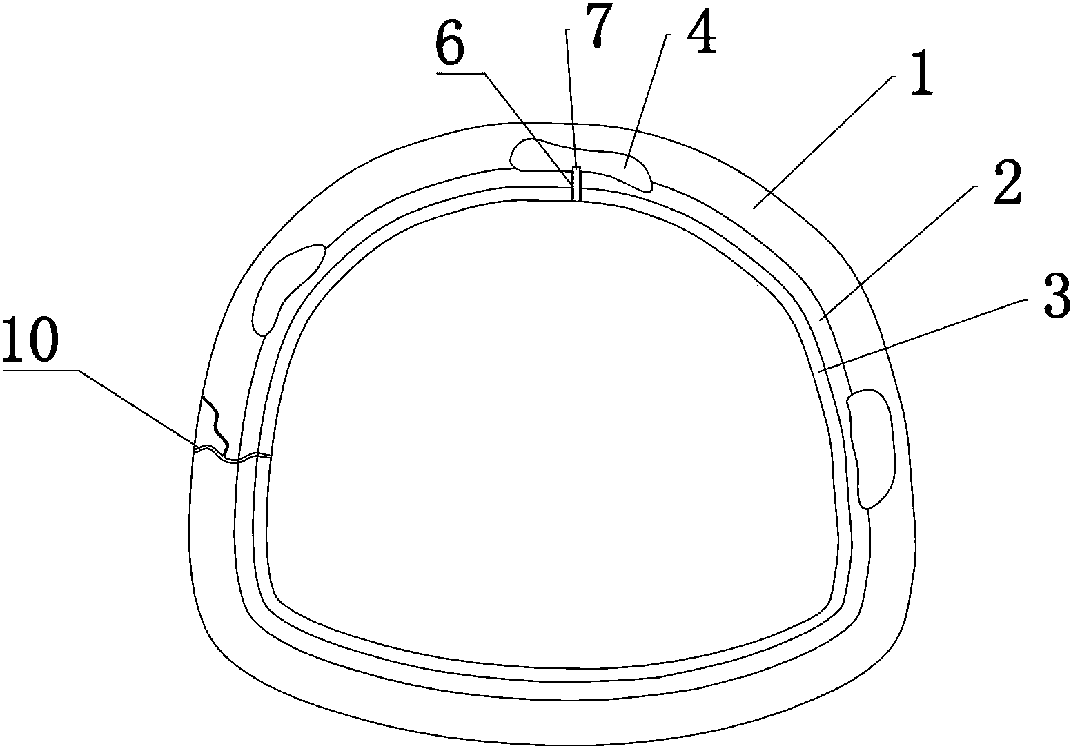 Method for solving disengagement and water seepage of internal arch of tunnel