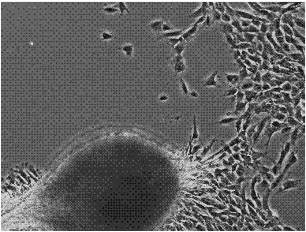 Umbilical cord tissue digestion method