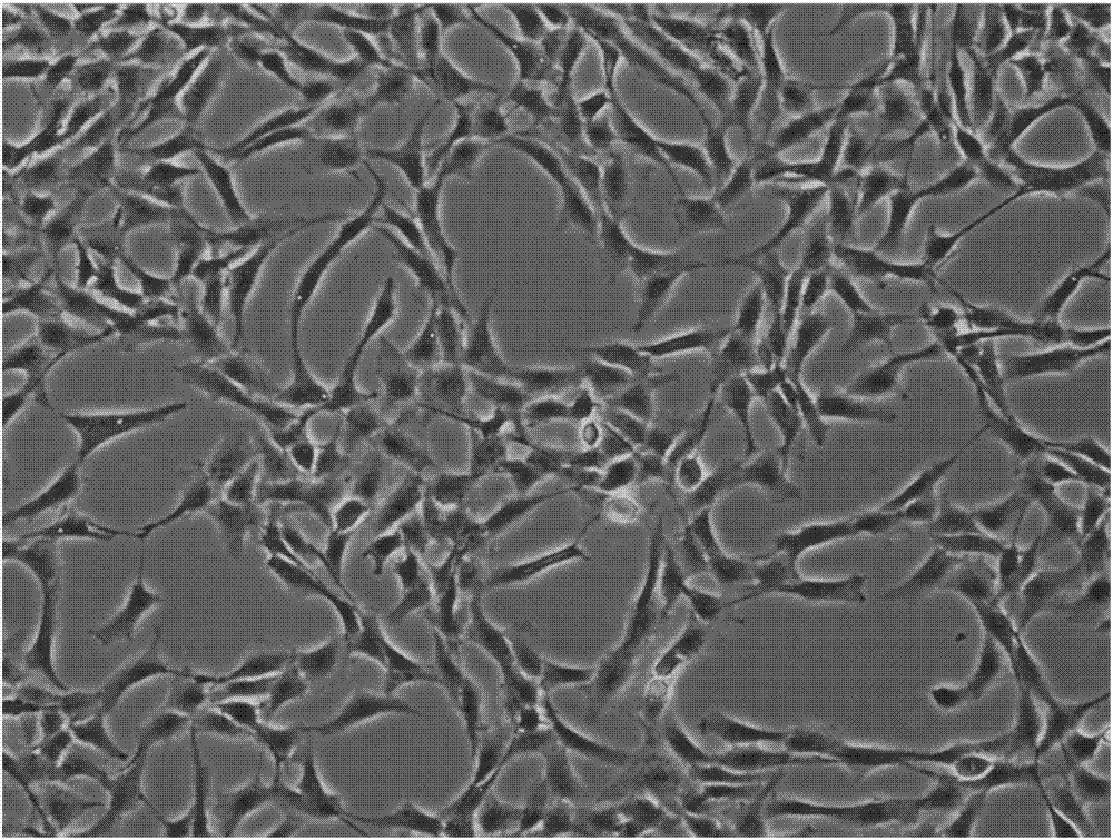 Umbilical cord tissue digestion method