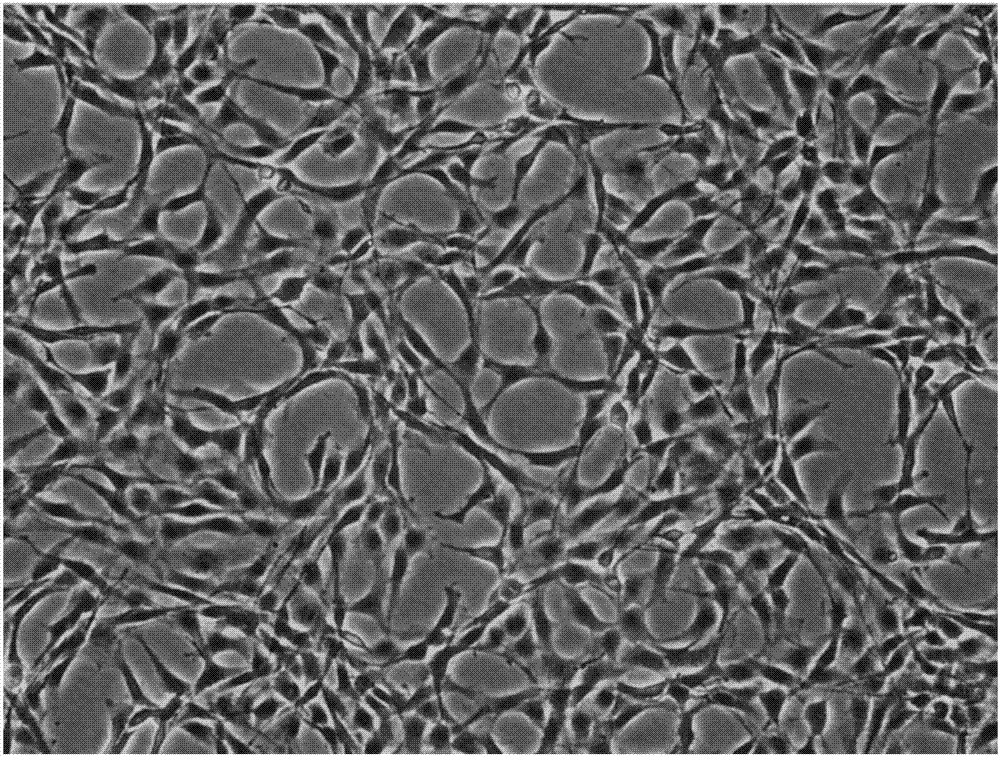 Umbilical cord tissue digestion method