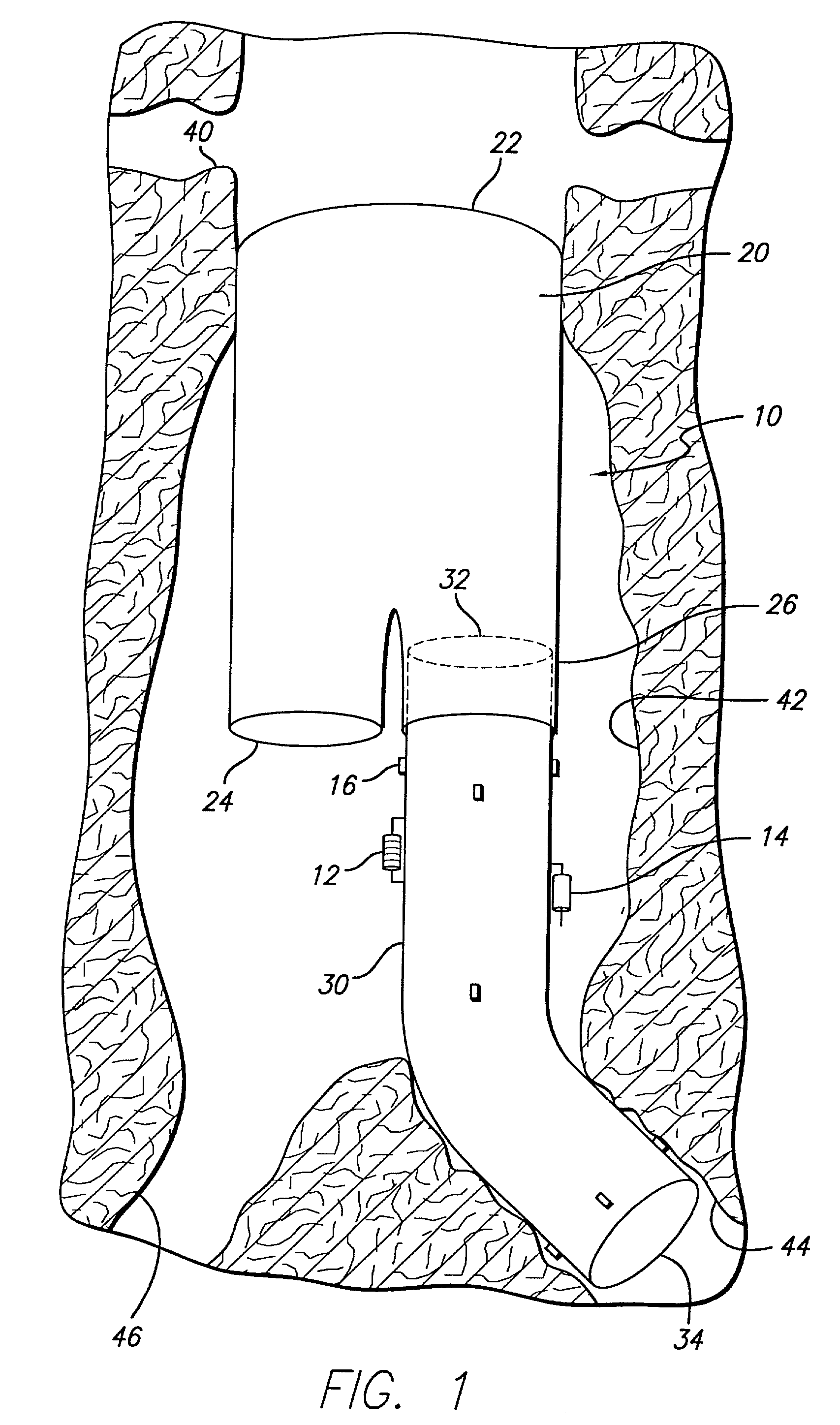 Endovascular graft with sensors design and attachment methods