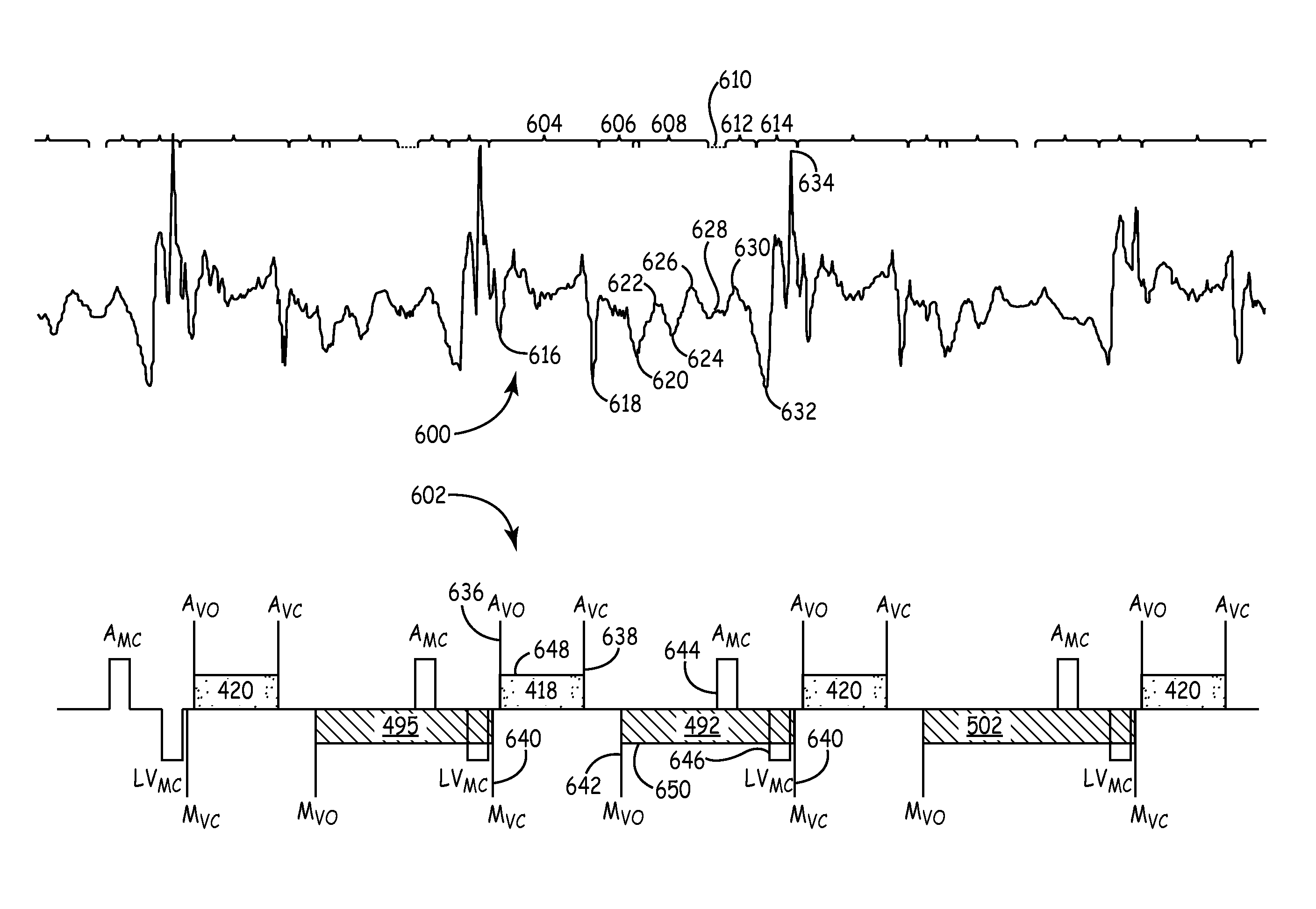 Mechanical function marker channel for cardiac monitoring and therapy control