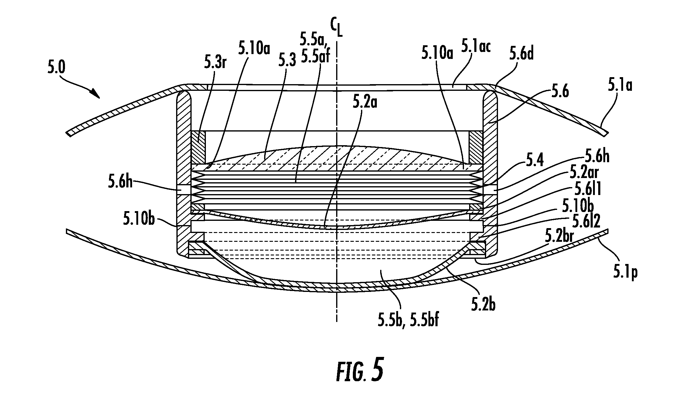 Anterior-Posterior-Capsule-Actuated Hydraulic Accommodative Intraocular Lenses and Lens Systems