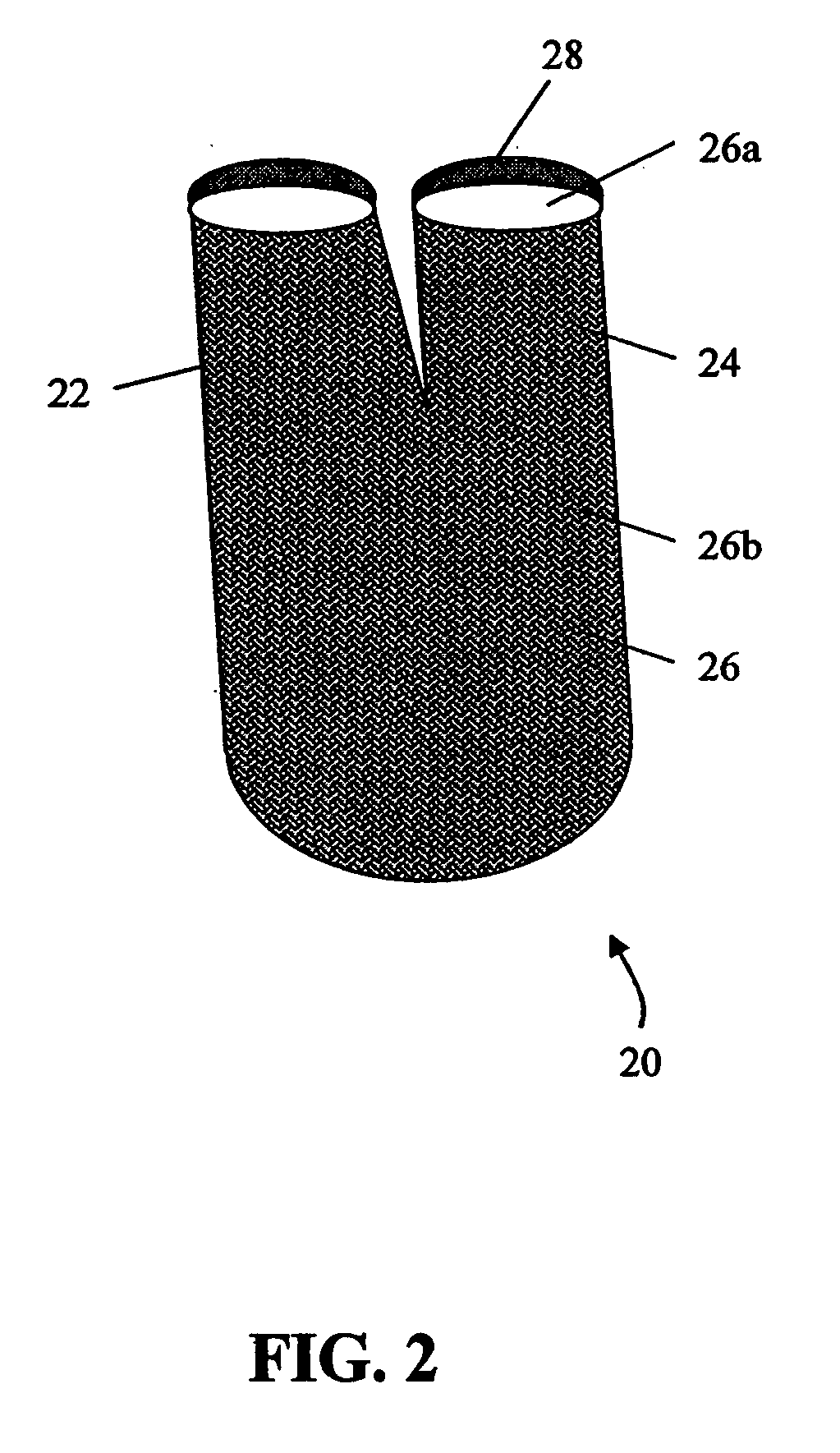 Implantable prosthesis having reinforced attachment sites