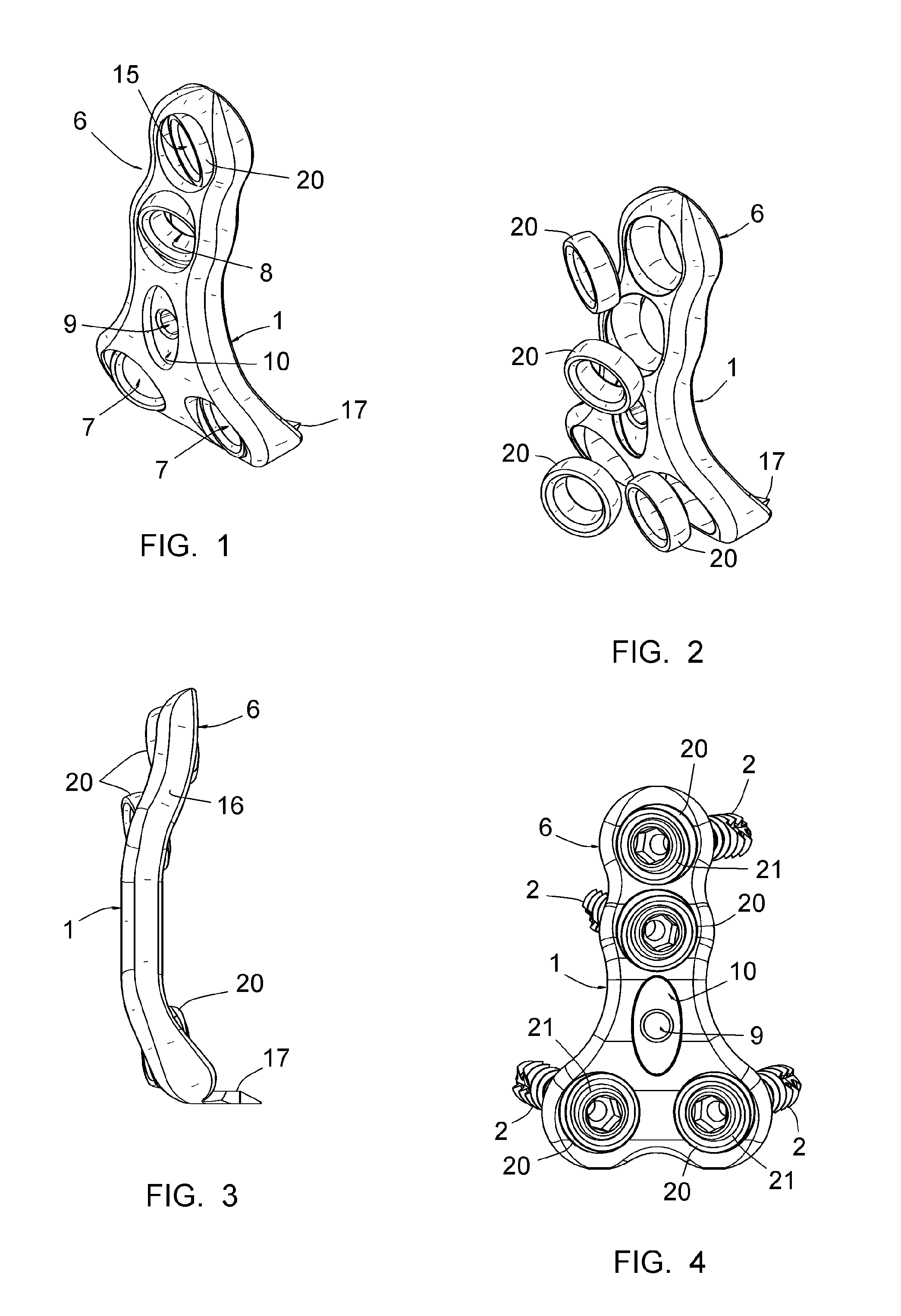 Osteosynthesis plate for lumbosacral joint