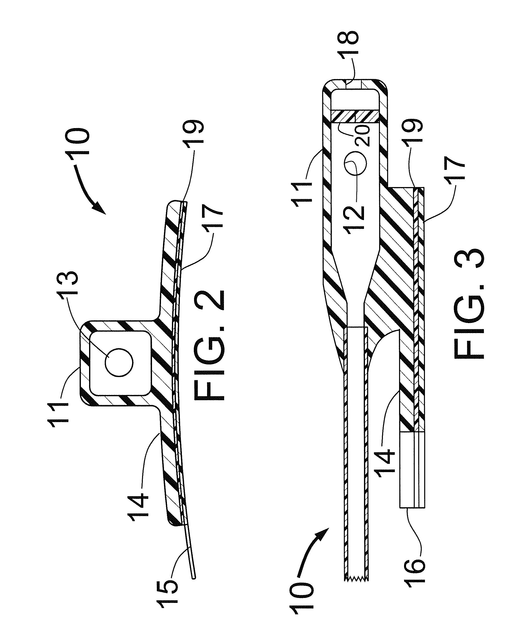 Introducer sheath having a hemostasis valve with an adhesive means for attachment to the skin