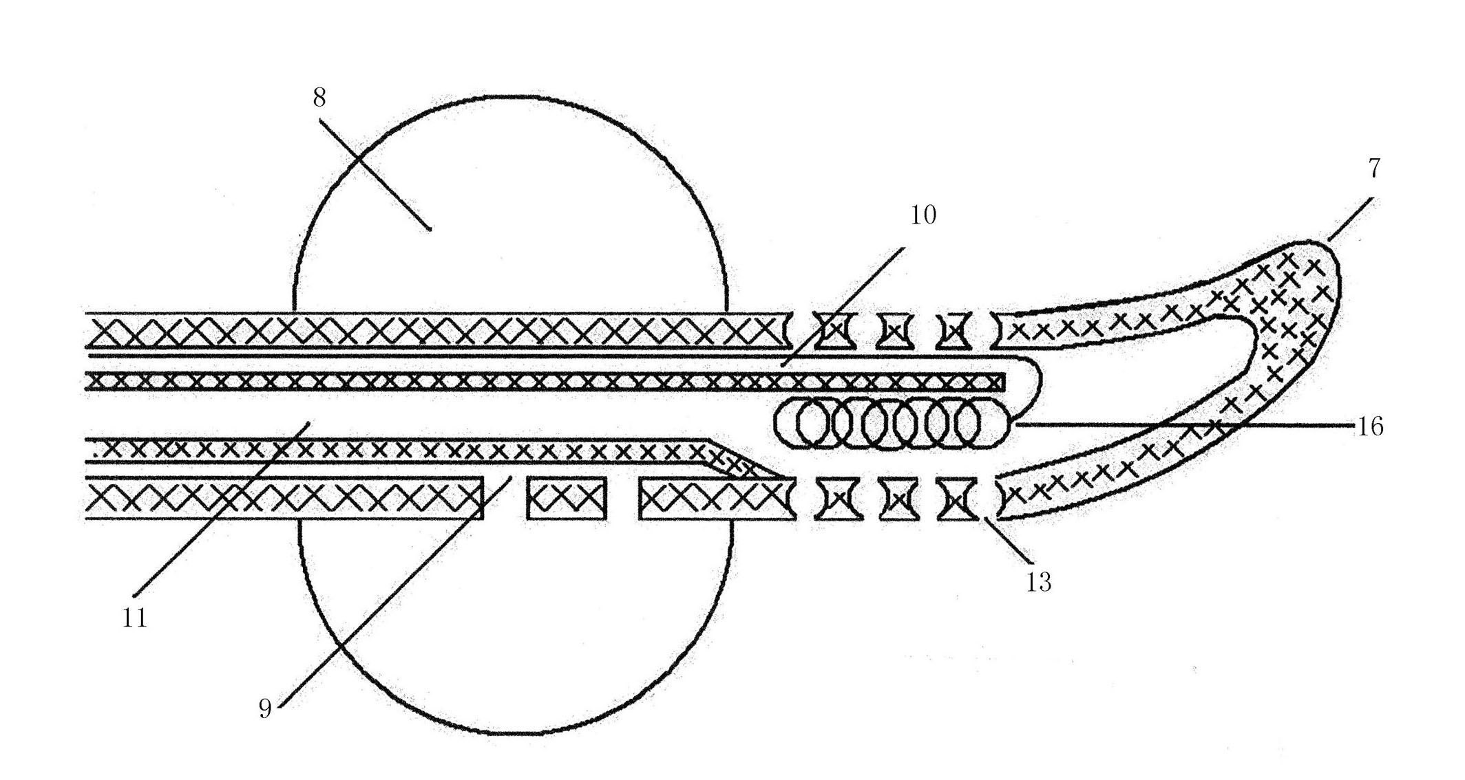 Zinc ion guide electrode conduit in prostate urethra