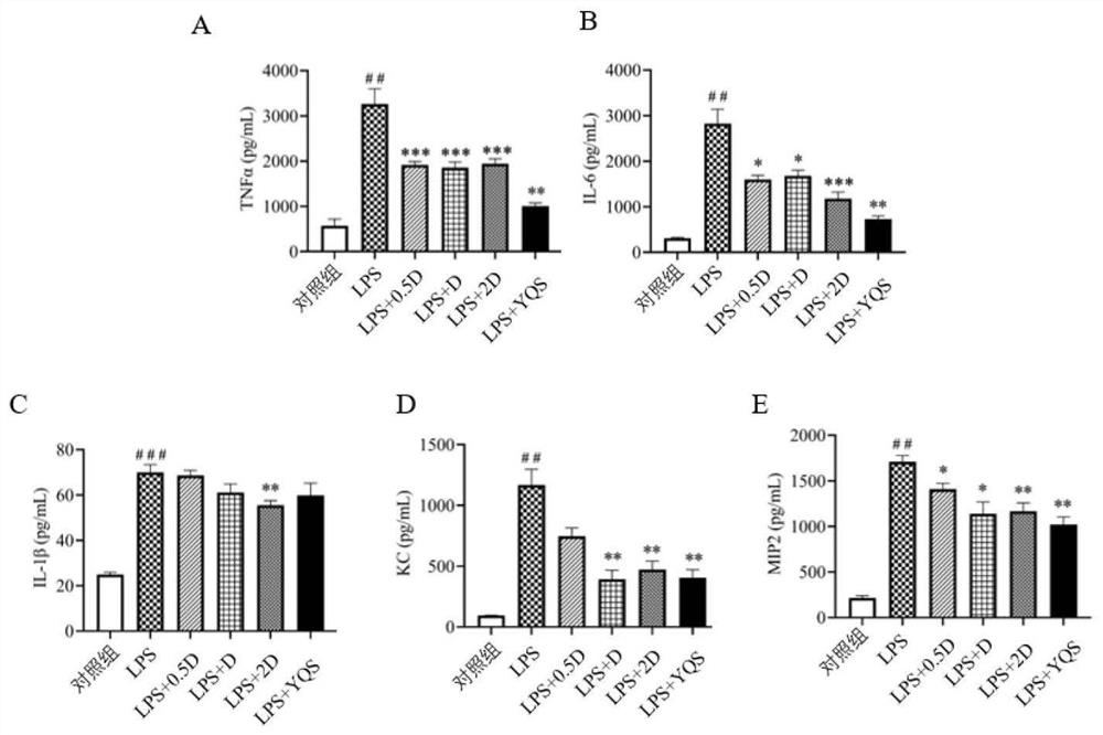 Traditional Chinese medicine compound preparation for treating novel coronavirus infection