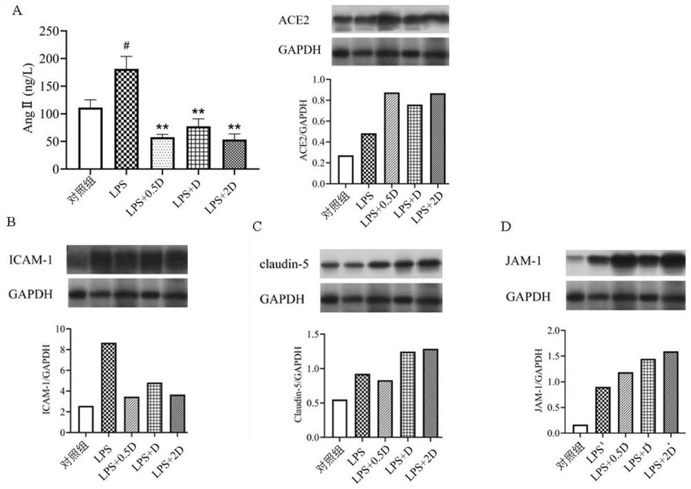 Traditional Chinese medicine compound preparation for treating novel coronavirus infection