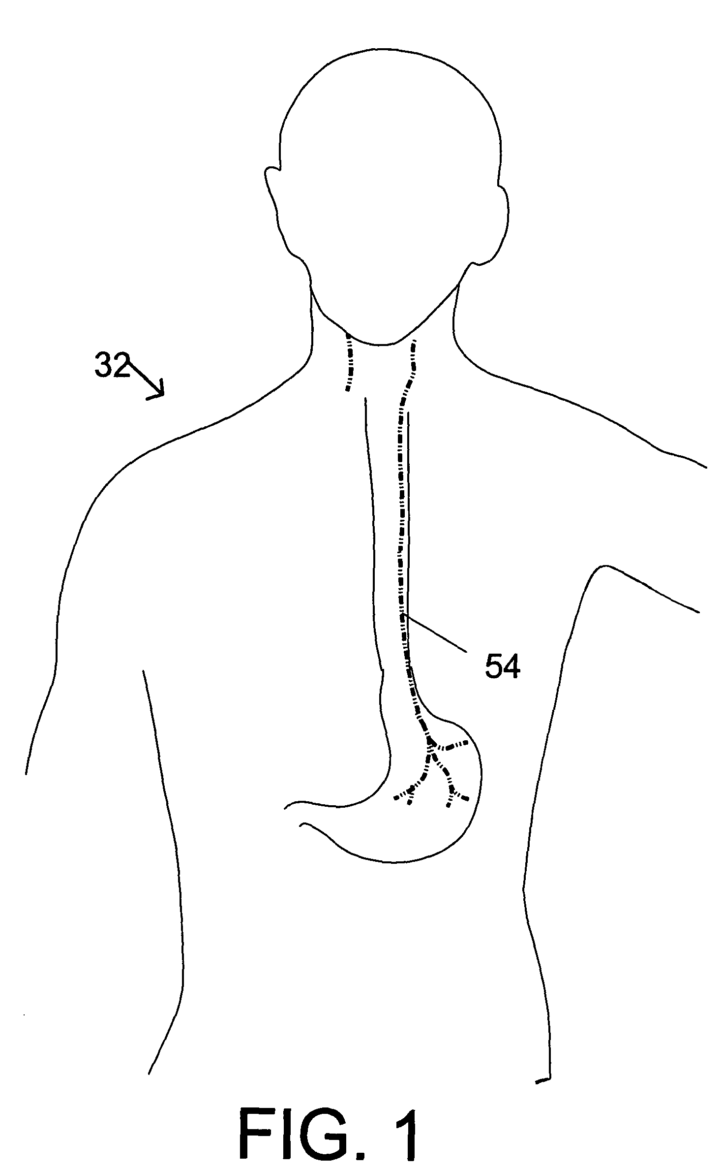 System and method for providing electrical pulses to the vagus nerve(s) to provide therapy for obesity, eating disorders, neurological and neuropsychiatric disorders with a stimulator, comprising bi-directional communication and network capabilities