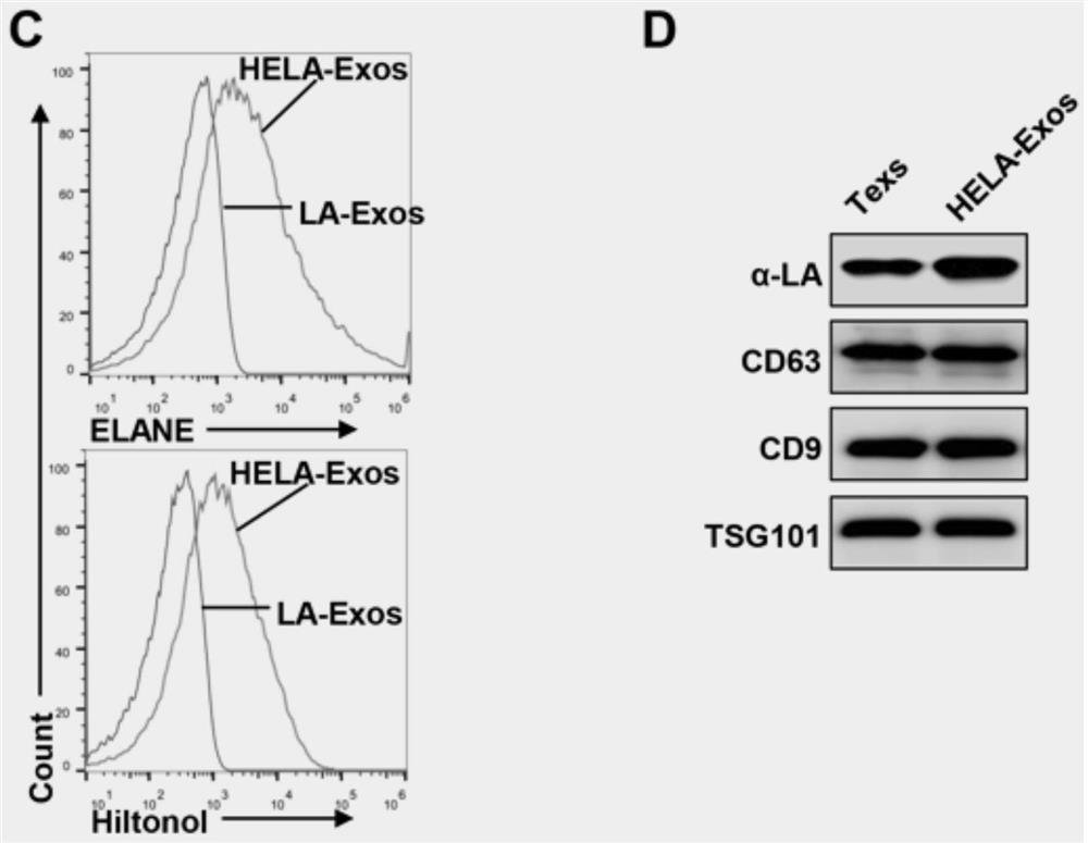 Engineered exosome in-situ nano vaccine as well as preparation method and application thereof