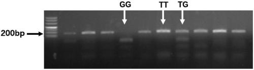 Molecular marker for improving fecundity of Sunit sheep and application of molecular marker